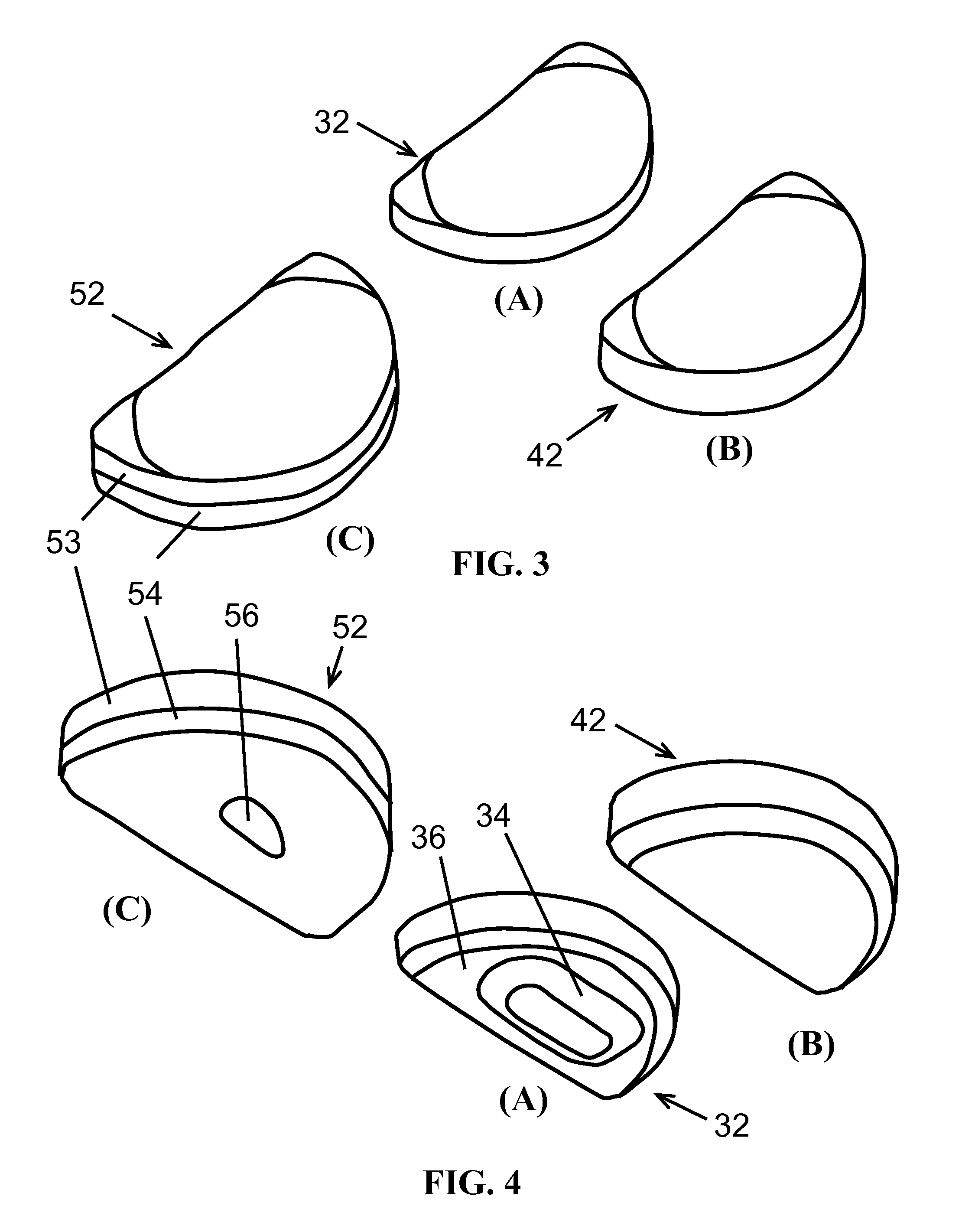 Midlay compartmental tibial component