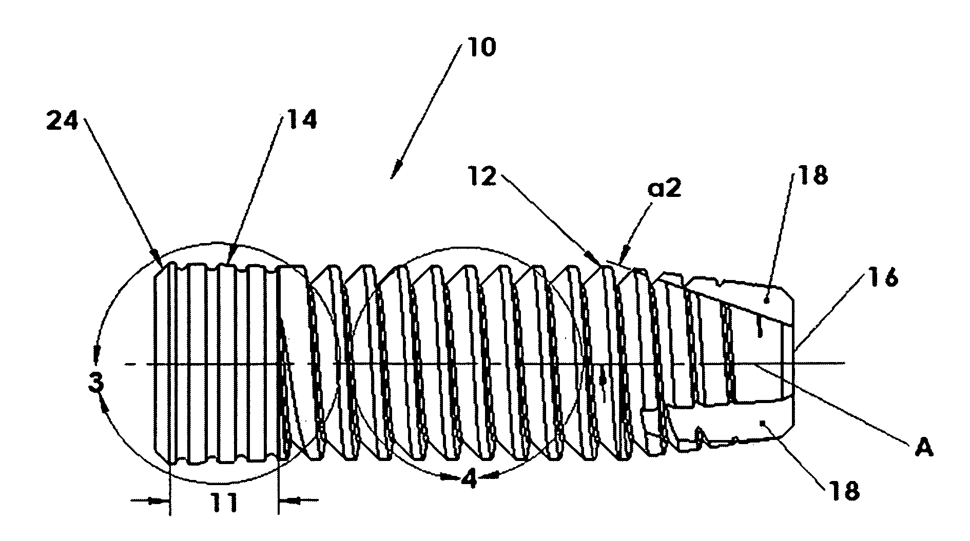 Dental Implant Identification System