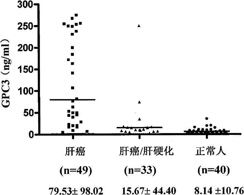 A monoclonal antibody for serological diagnosis of liver cancer and its use