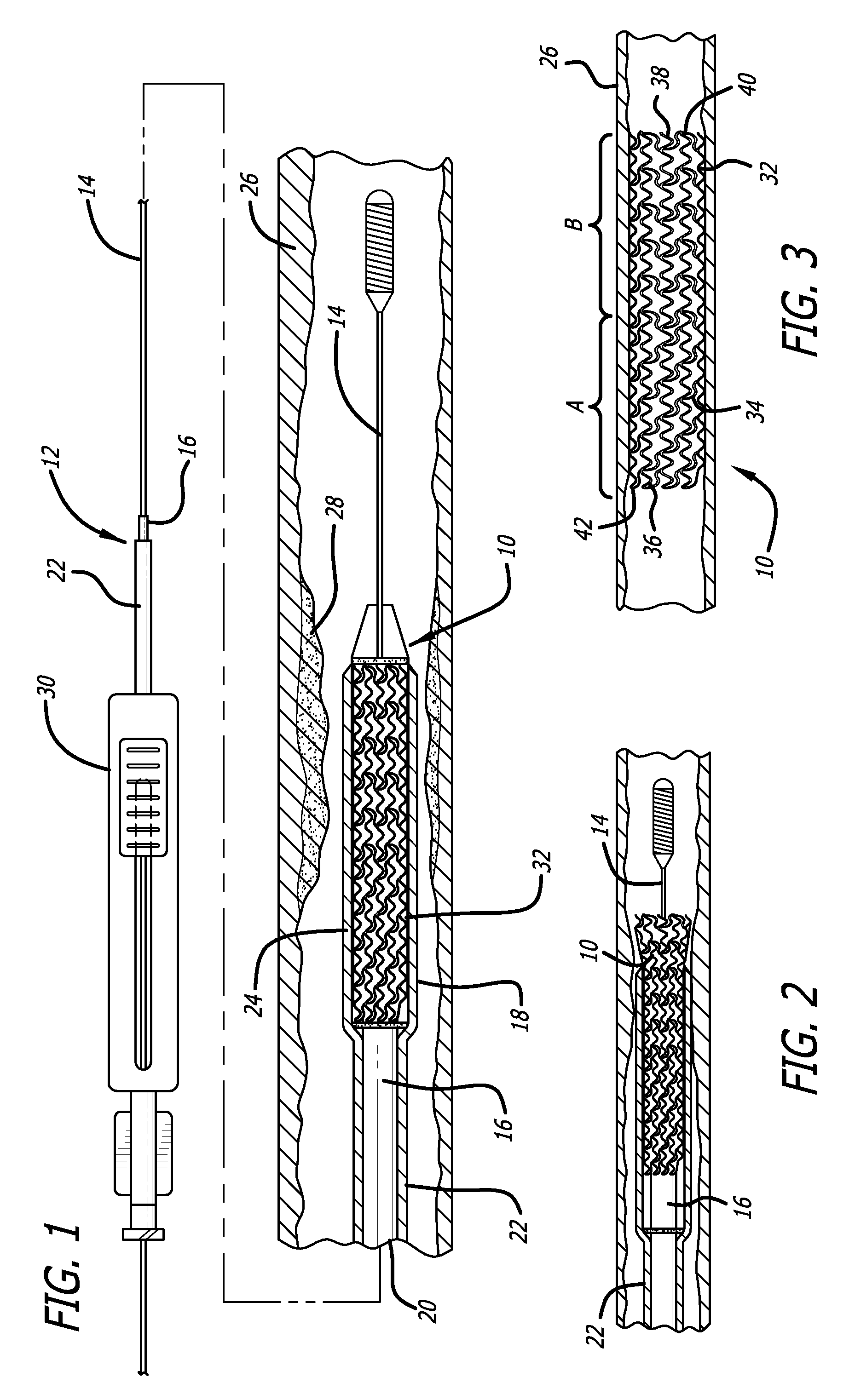 Endoprostheses for peripheral arteries and other body vessels