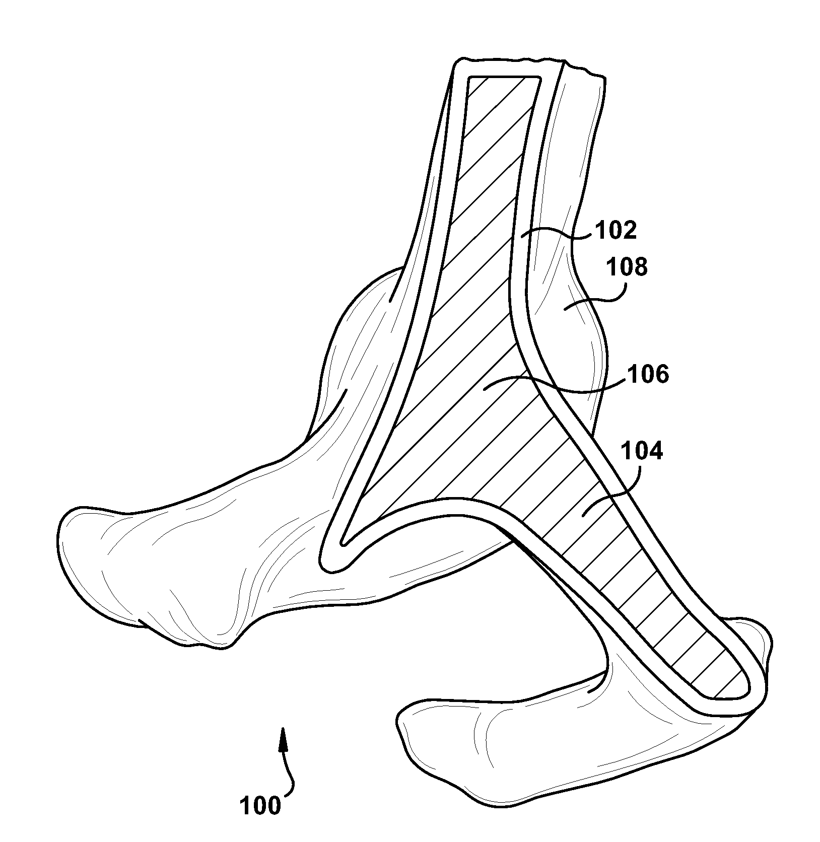 Synthetic bone model and method for providing same