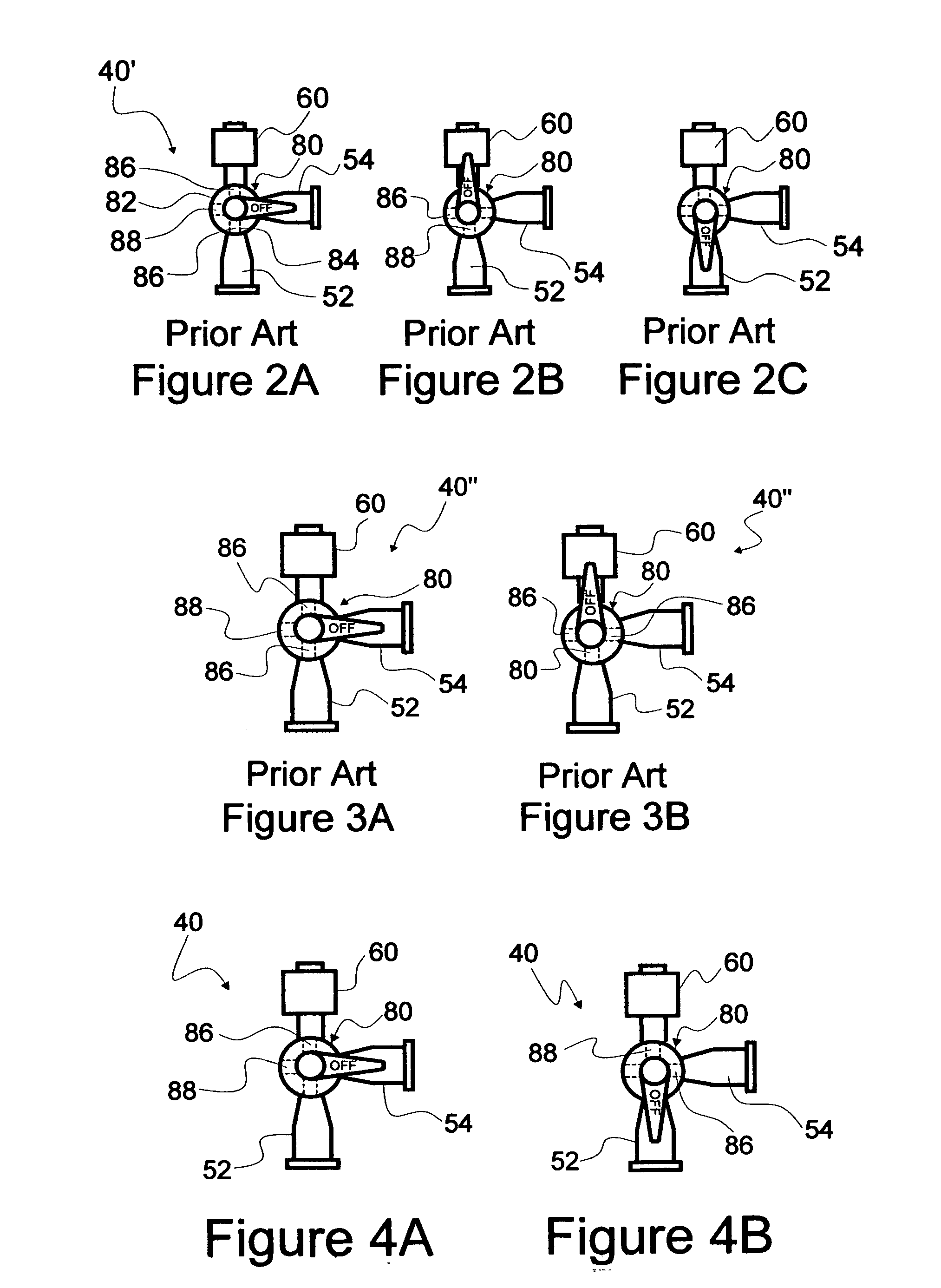 Convenience IV kits and methods of use