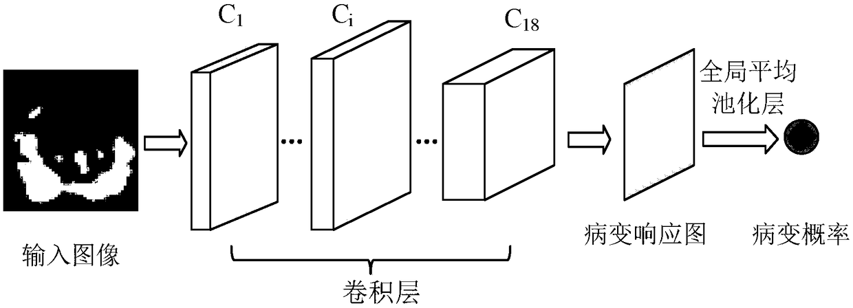 Lesion identification method and device, computer device, and readable storage medium