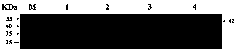 Hybridoma cell strain secreting anti human IL-37 monoclonal antibody and anti human IL-37 monoclonal antibody and application thereof