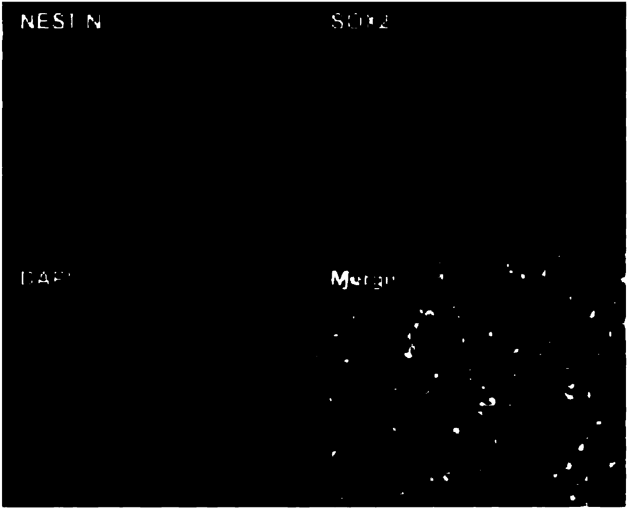 Kit and method for in vitro directed differentiation of human iPS stem cells into neurons