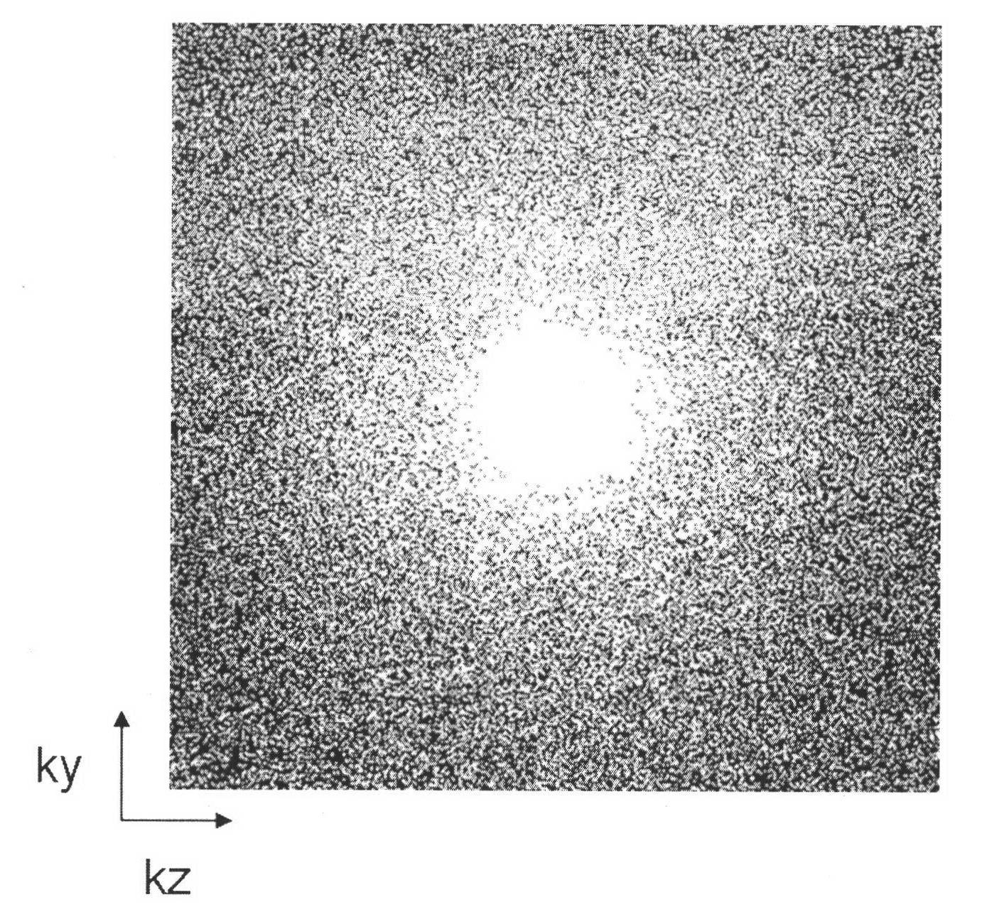 Rapid magnetic resonance imaging (MRI) method based on CS ( compressed sensing ) technique