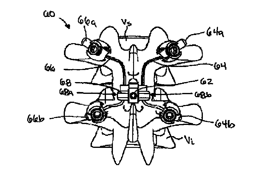 Posterior dynamic stabilization cross connectors