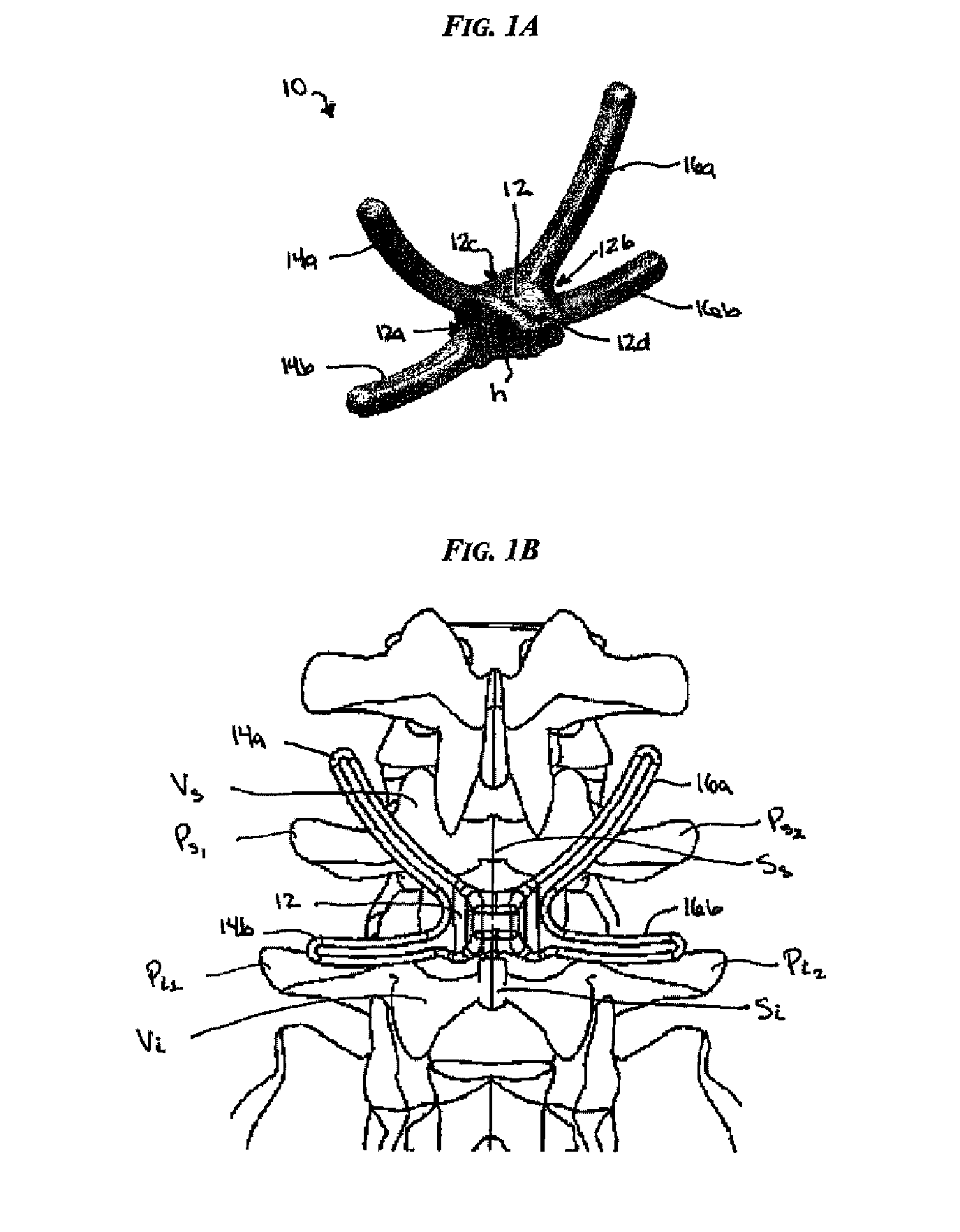 Posterior dynamic stabilization cross connectors