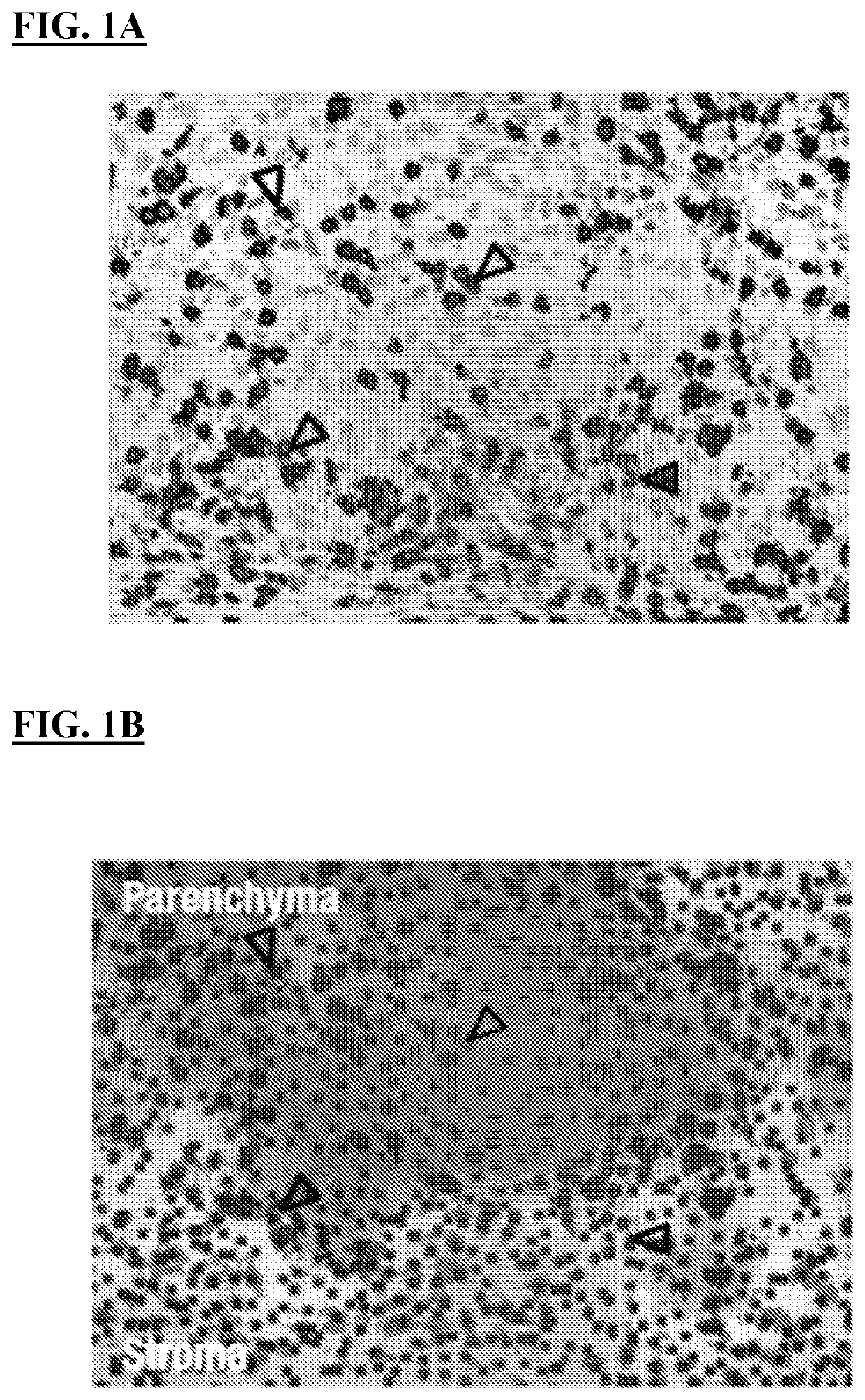 Cell localization signature and combination therapy