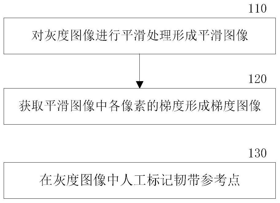 Ankle ligament separation method and separation system in medical imaging