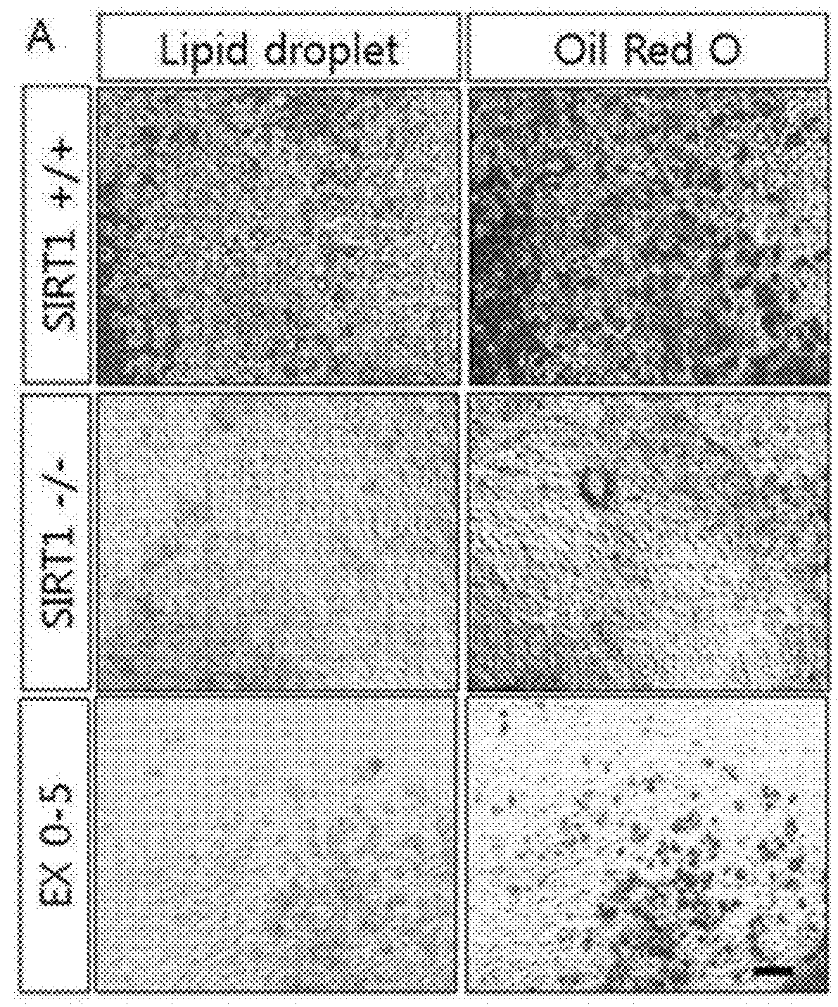 Method for controlling differentiation of embryonic stem cells into adipocytes or kidney precursor cells by regulating sirt1 expression