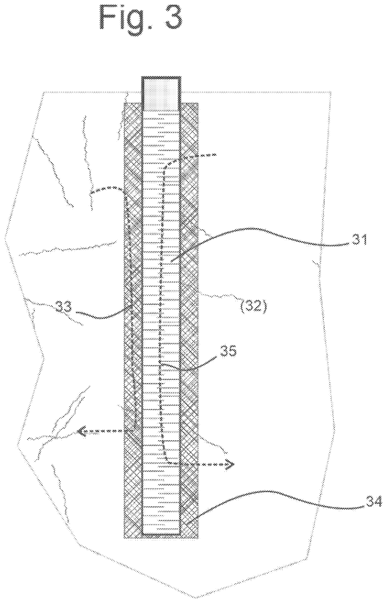 Optimal Screened Subsurface Well Design