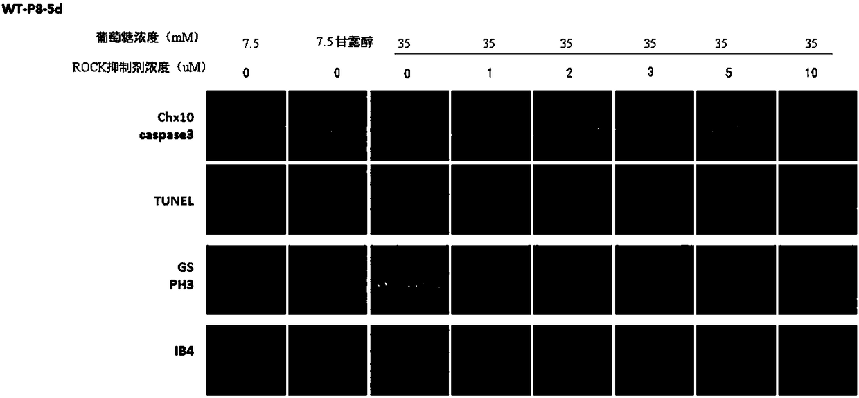 Flavonoid derivative with ROCK kinase inhibiting effect