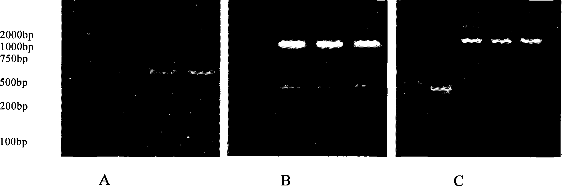 Retroviral vector for expression of glial cell line-derived neurotrophic factor and use thereof