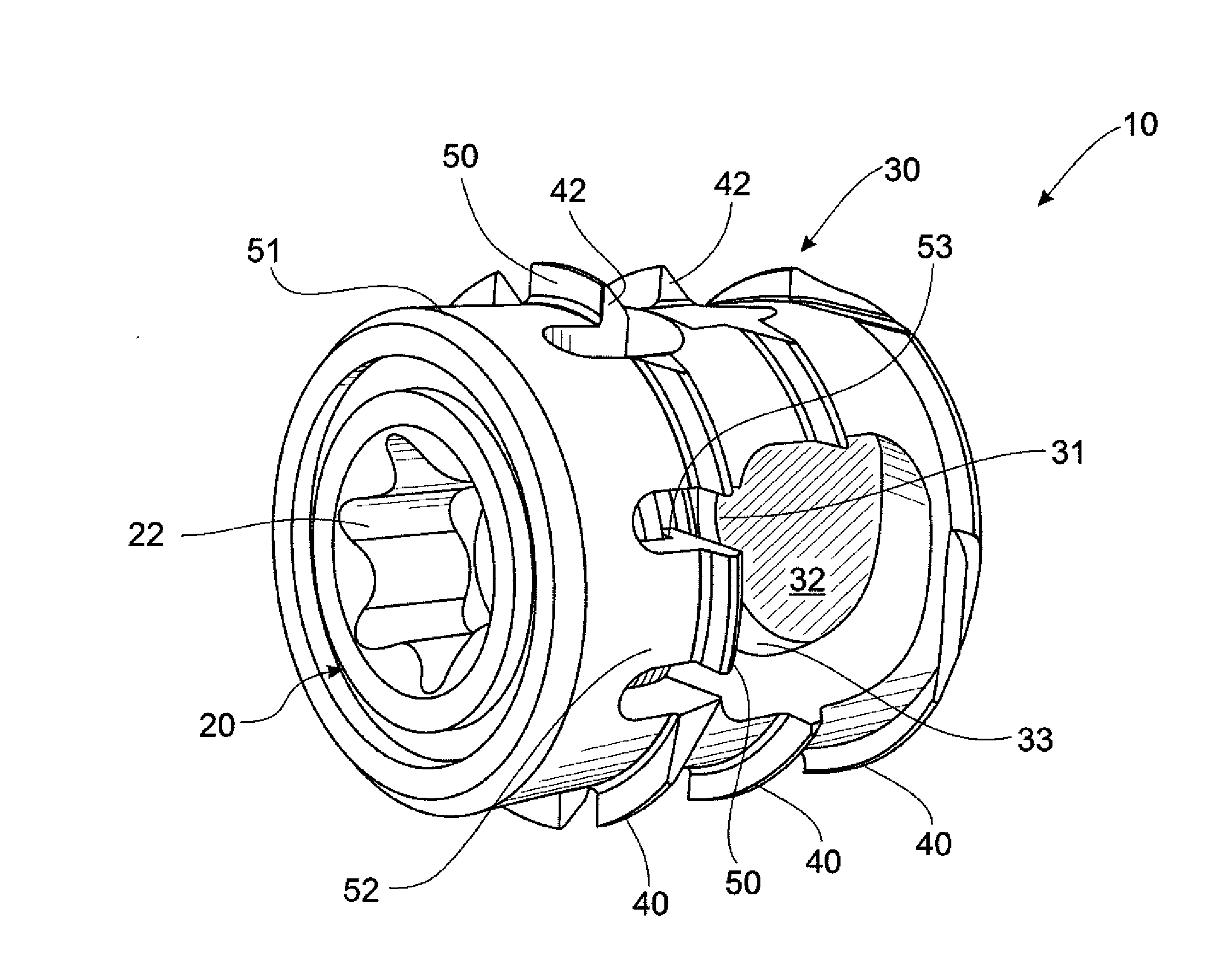 Joint implant and a surgical method associated therewith