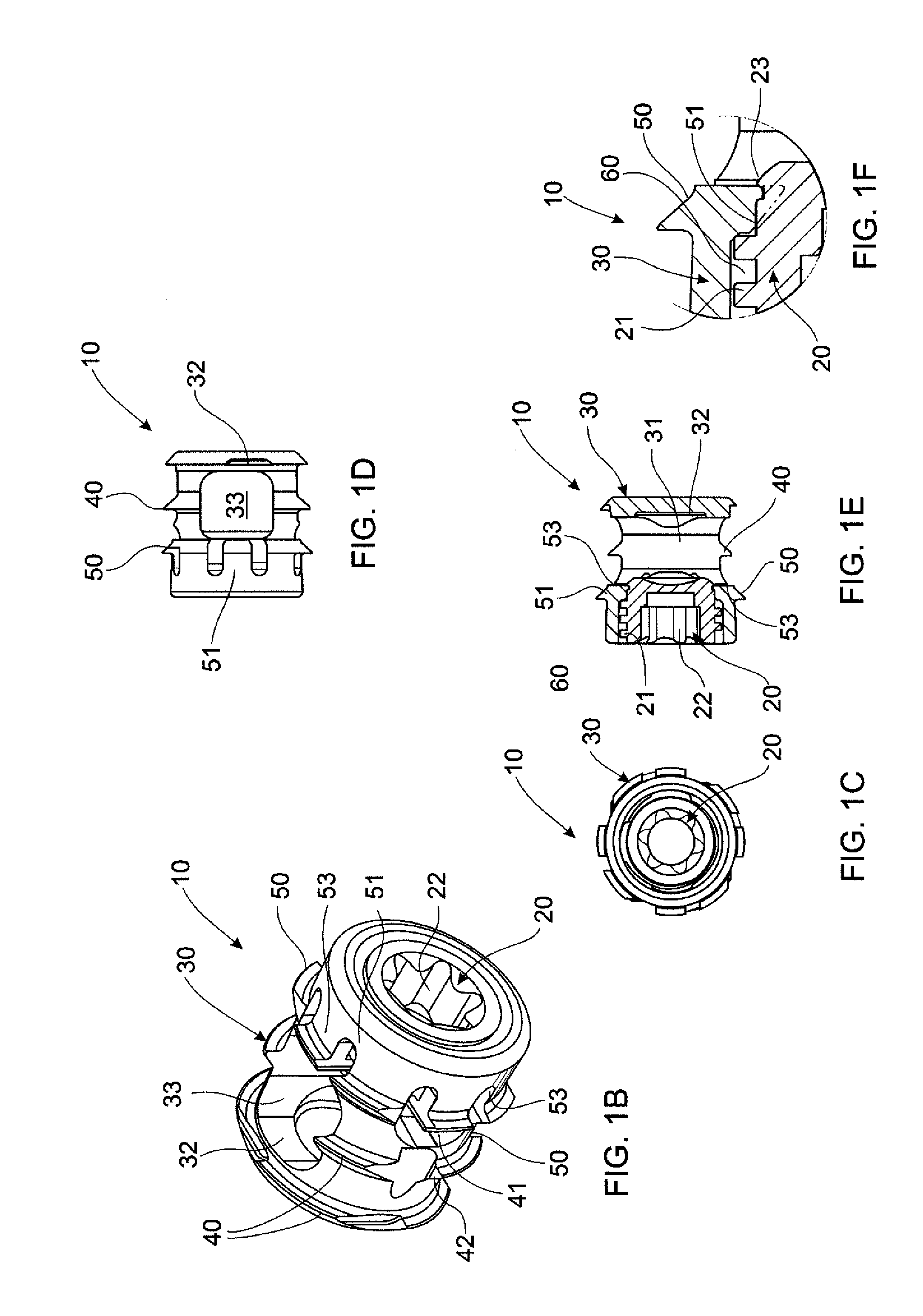 Joint implant and a surgical method associated therewith