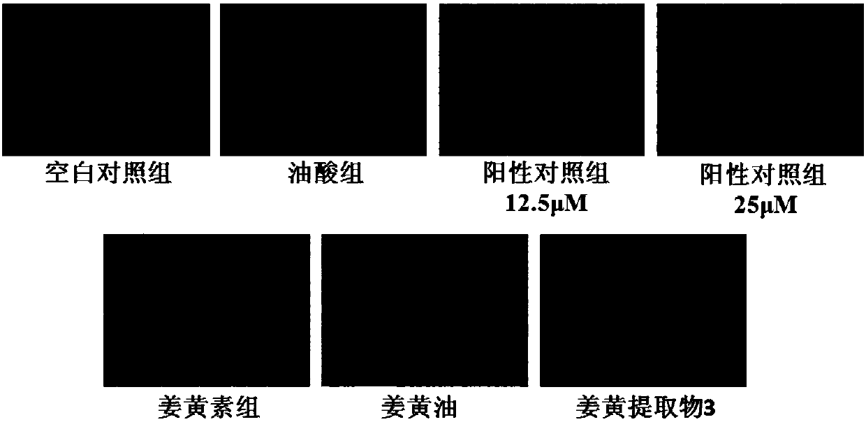 Turmeric extract, preparation method and use thereof, and health care product