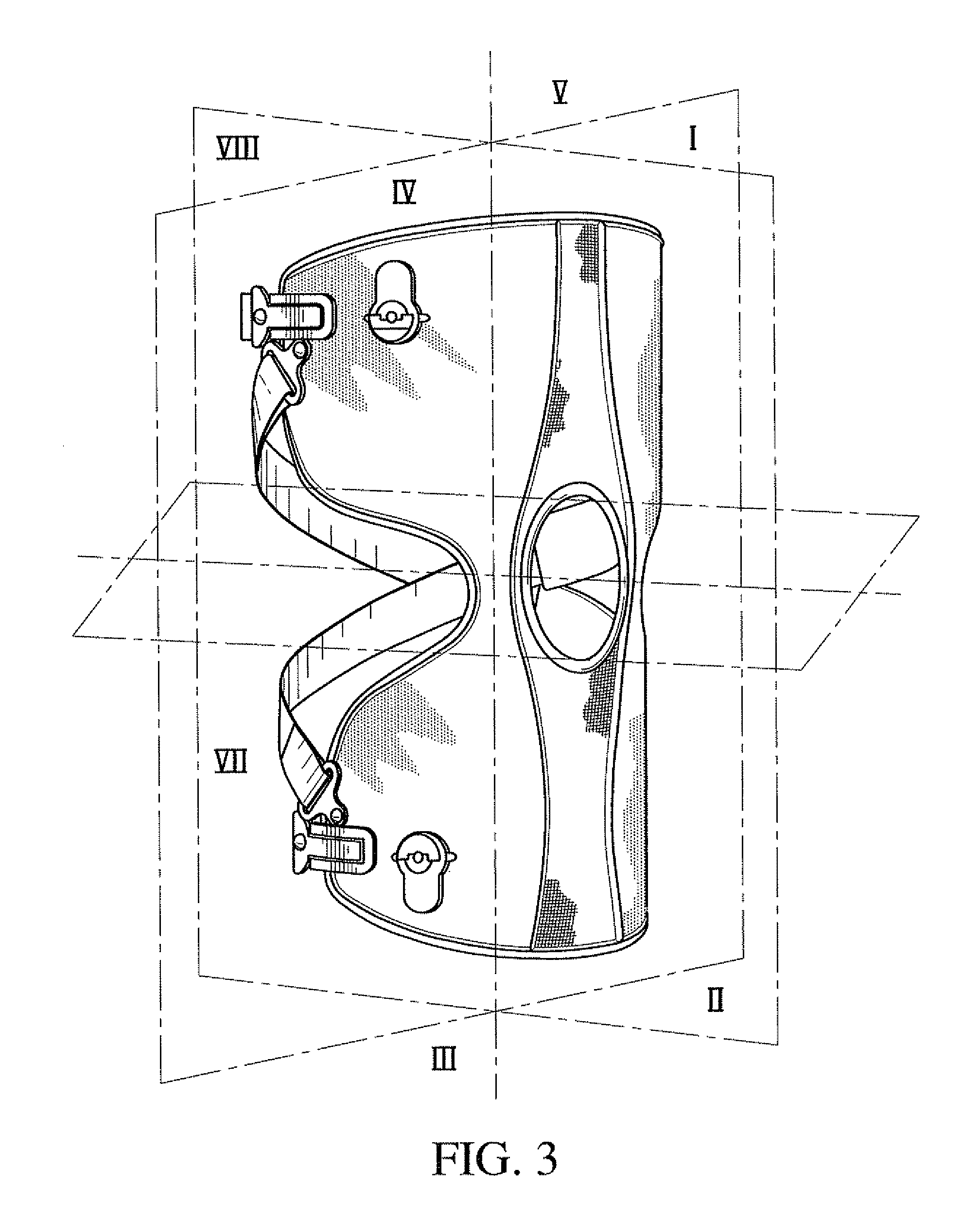 Orthopedic device