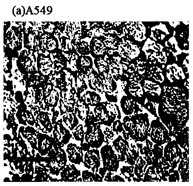 Precise lung cancer tissue location method based on SVM model and combining image