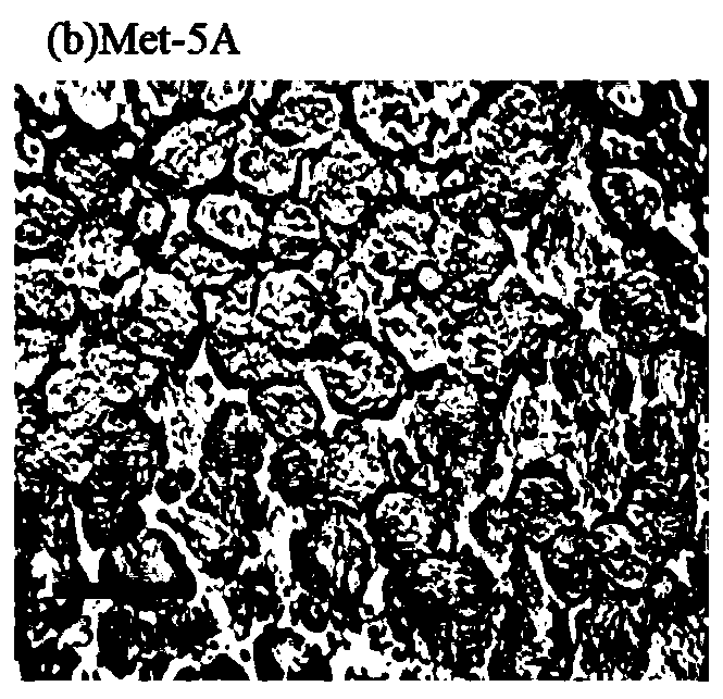 Precise lung cancer tissue location method based on SVM model and combining image