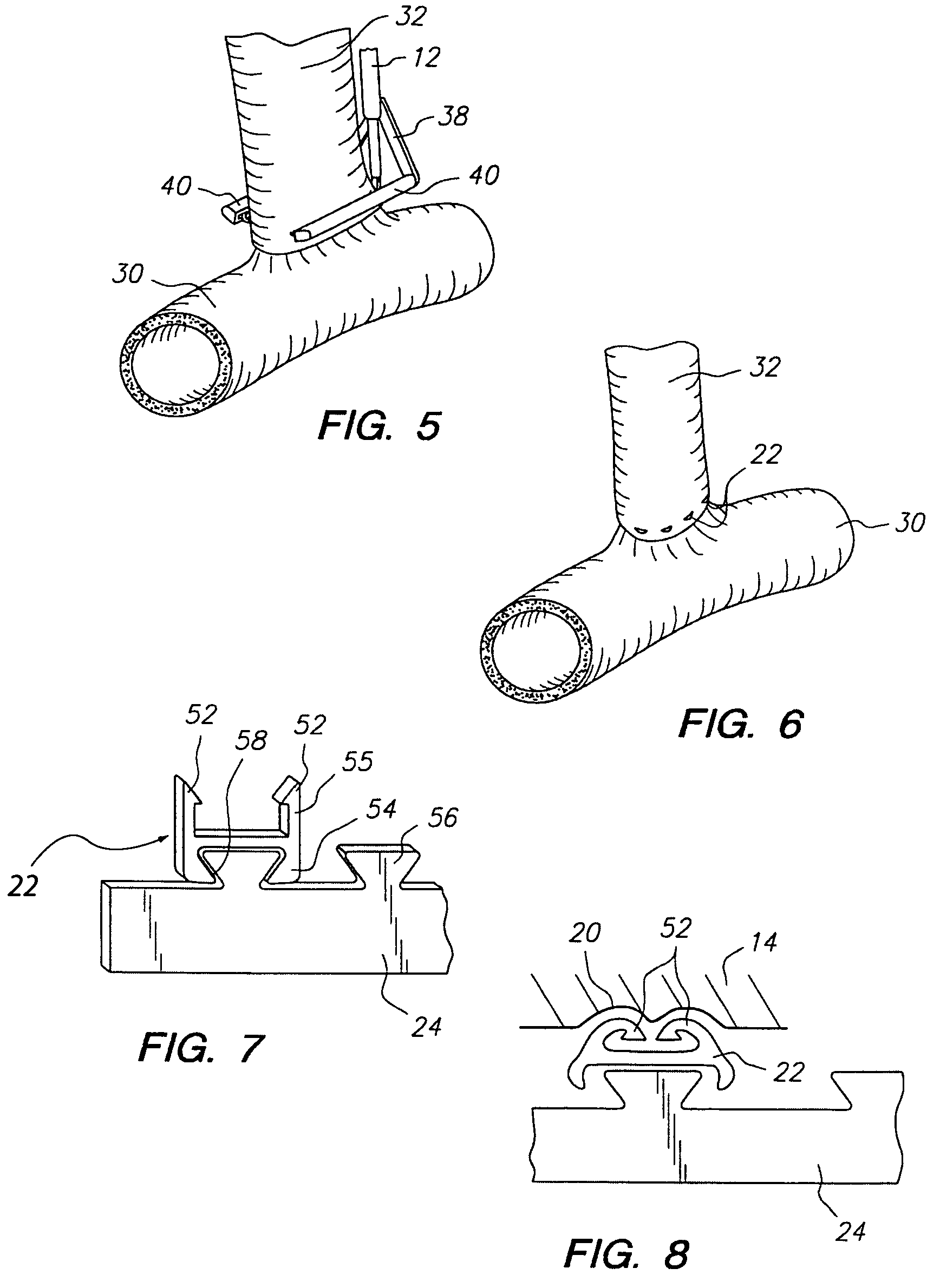 System for performing anastomosis