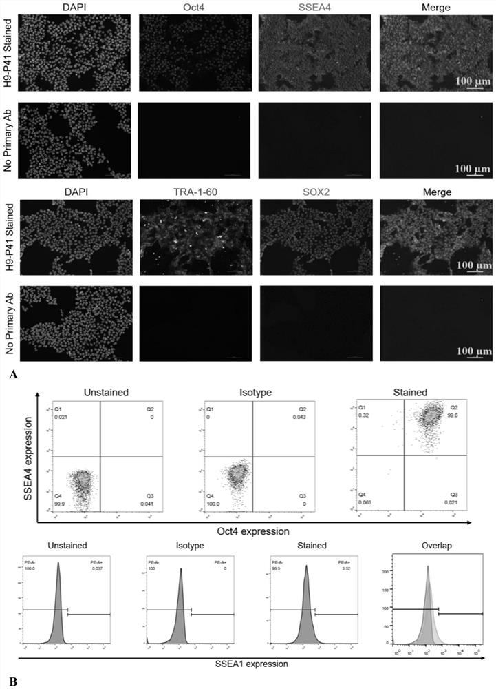 Method for preparing pancreatic beta cells and application of pancreatic beta cells