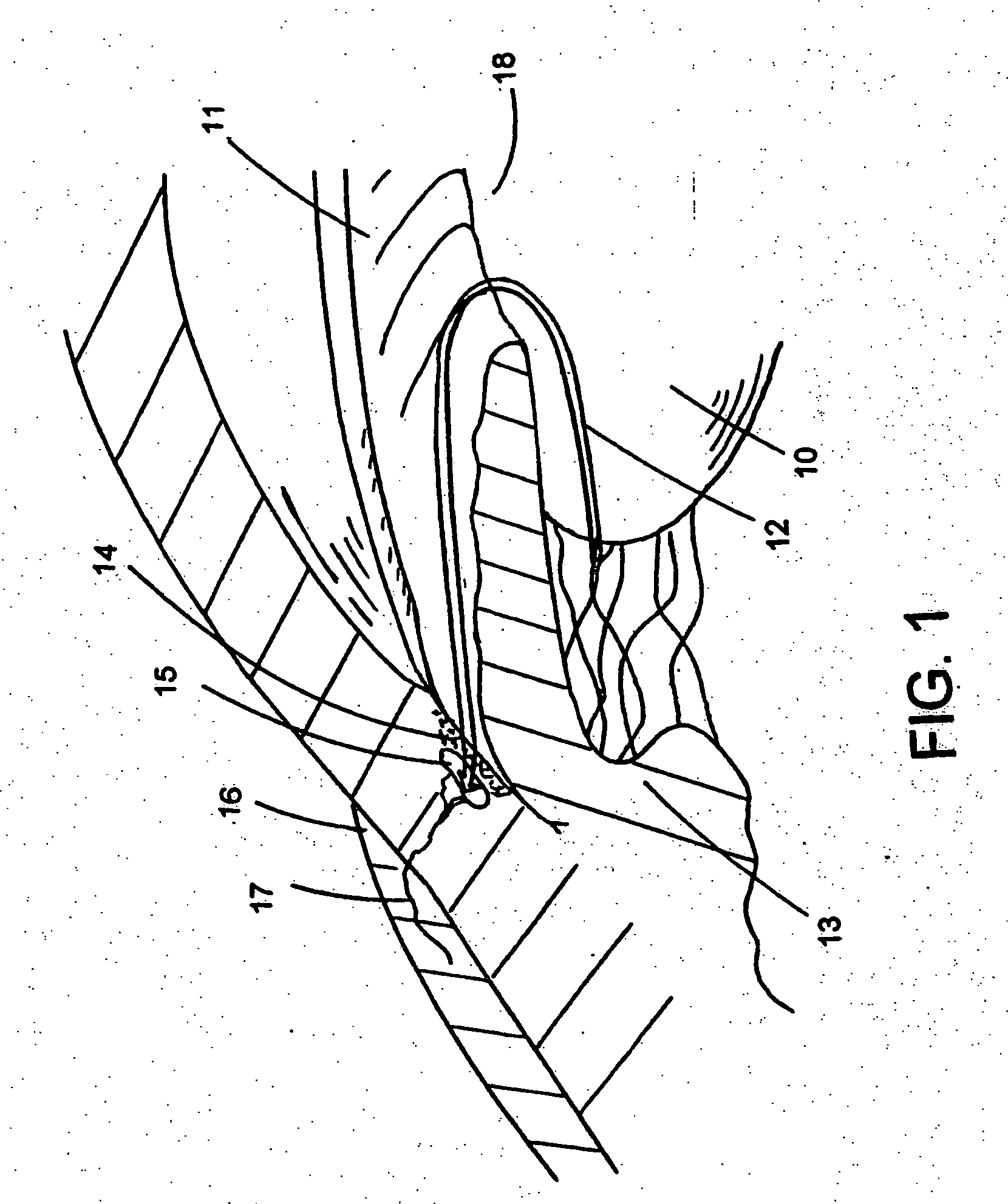 Optically powered and optically data-transmitting wireless intraocular pressure sensor device