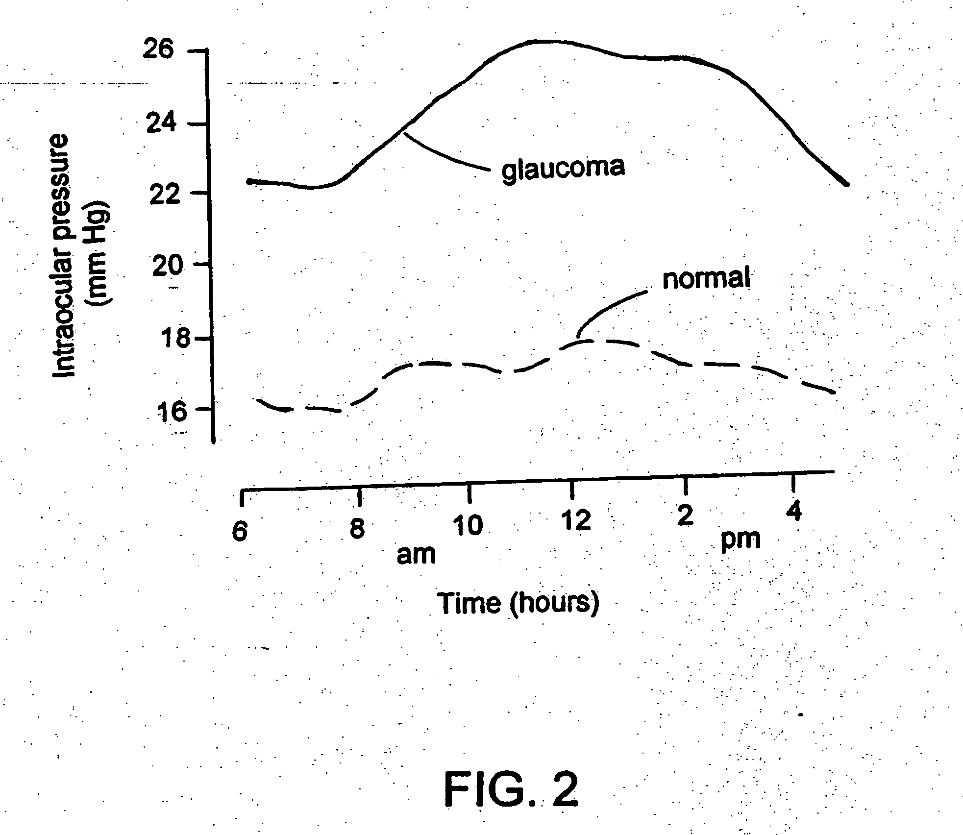 Optically powered and optically data-transmitting wireless intraocular pressure sensor device