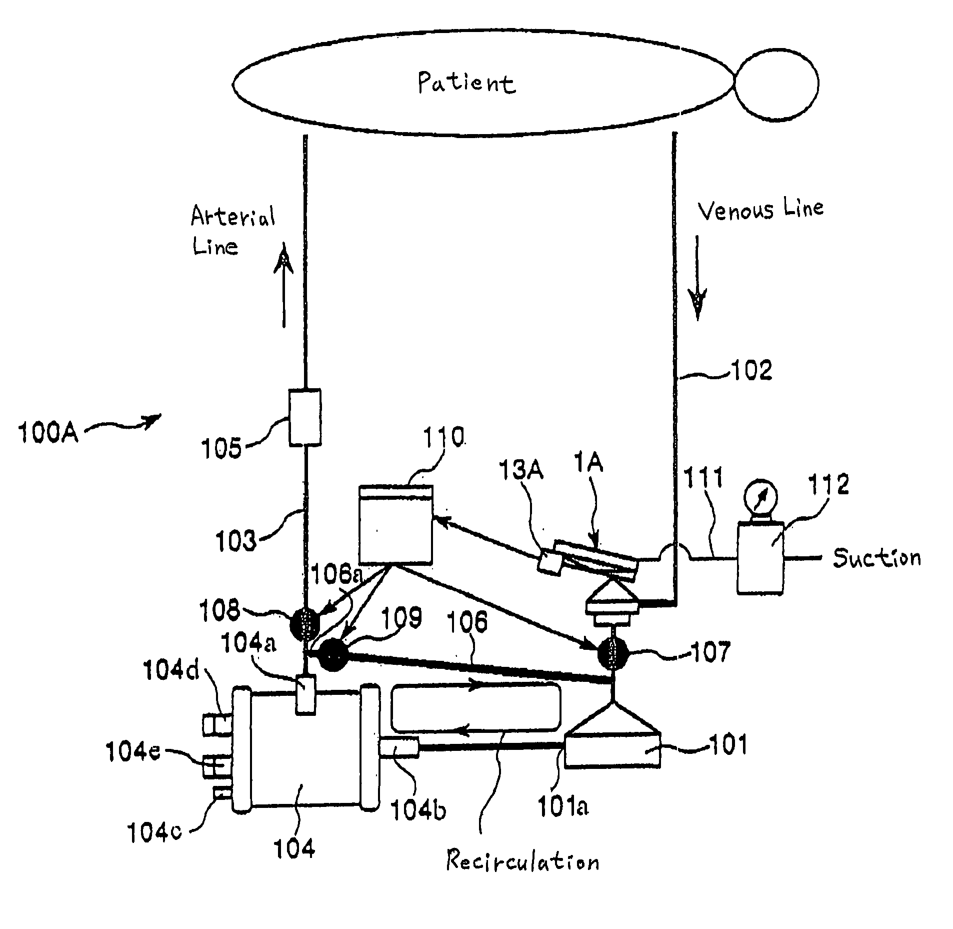 Extracorporeal Circulator