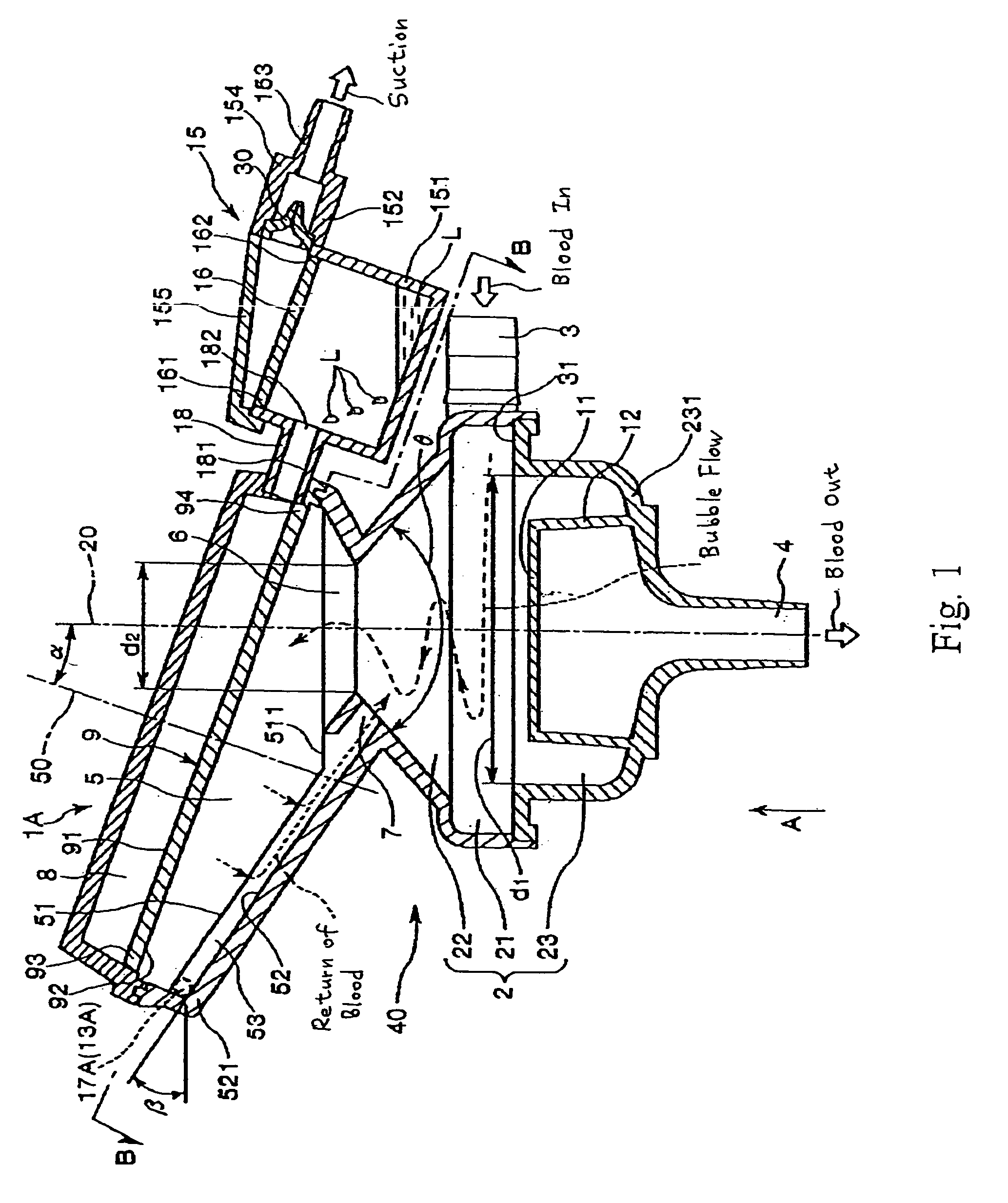 Extracorporeal Circulator