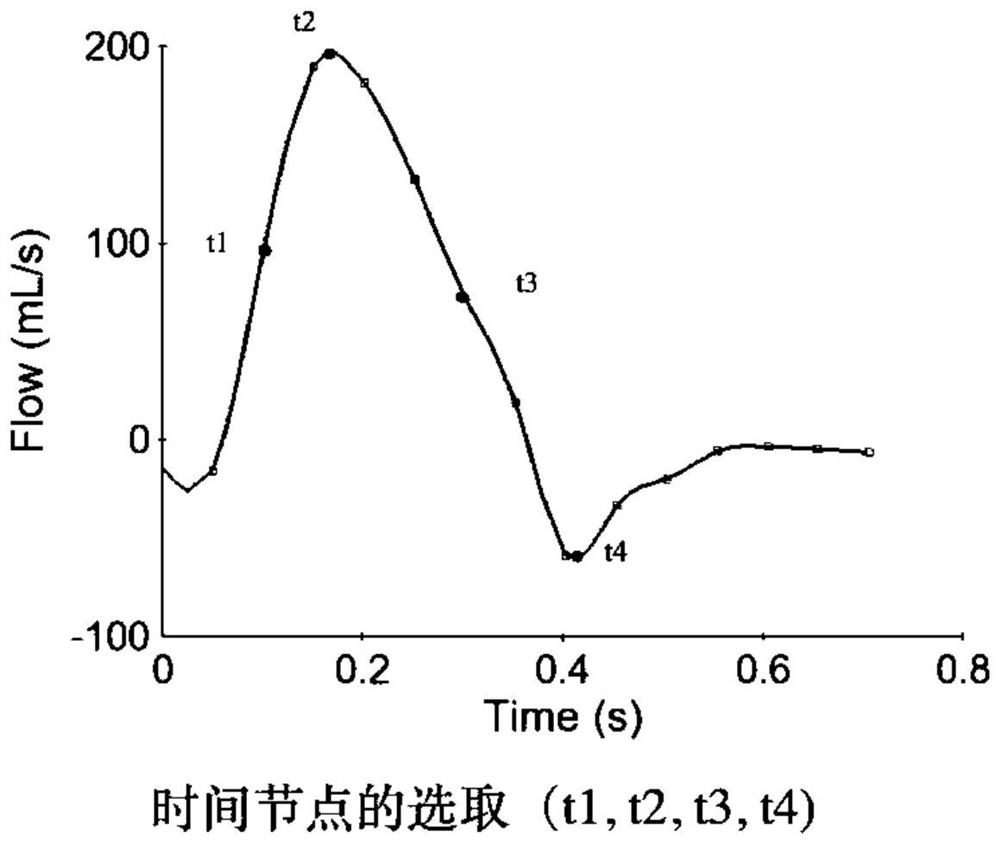 Aortic dissection endoluminal repair postoperative false lumen blood flow state evaluation method