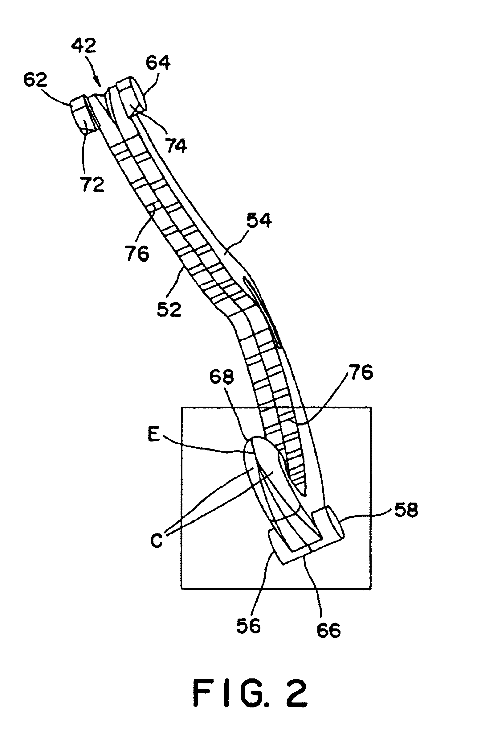 Ligating clip with integral penetrating hook