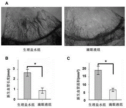 Application of celastrol to preparing eye drop preparation for inhibiting alkali burn corneal neovascularization and promoting corneal alkali burn healing