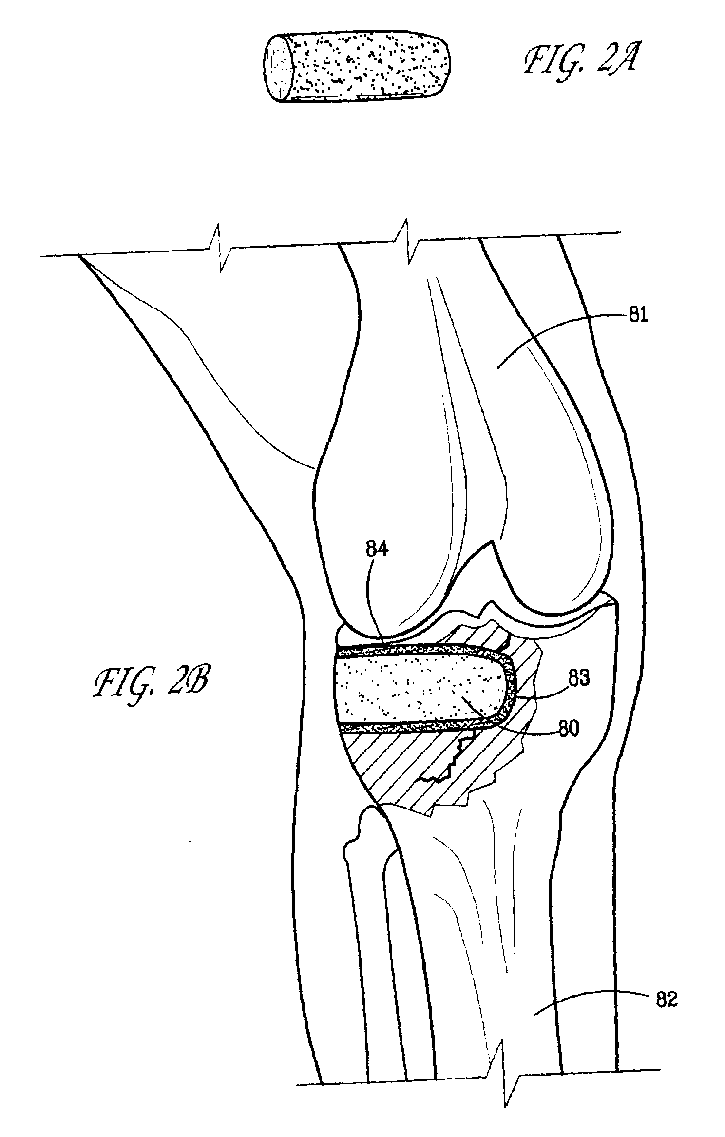 Biologically active composites and methods for their production and use