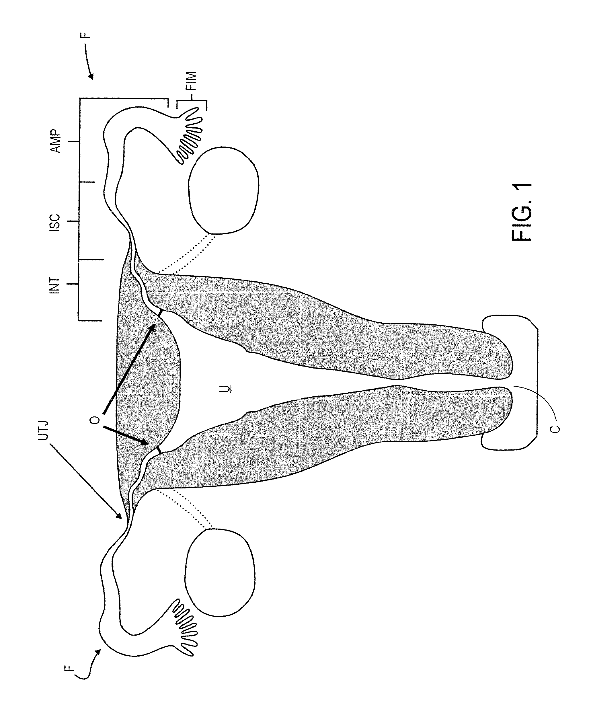 Medical devices and methods of making and using such devices