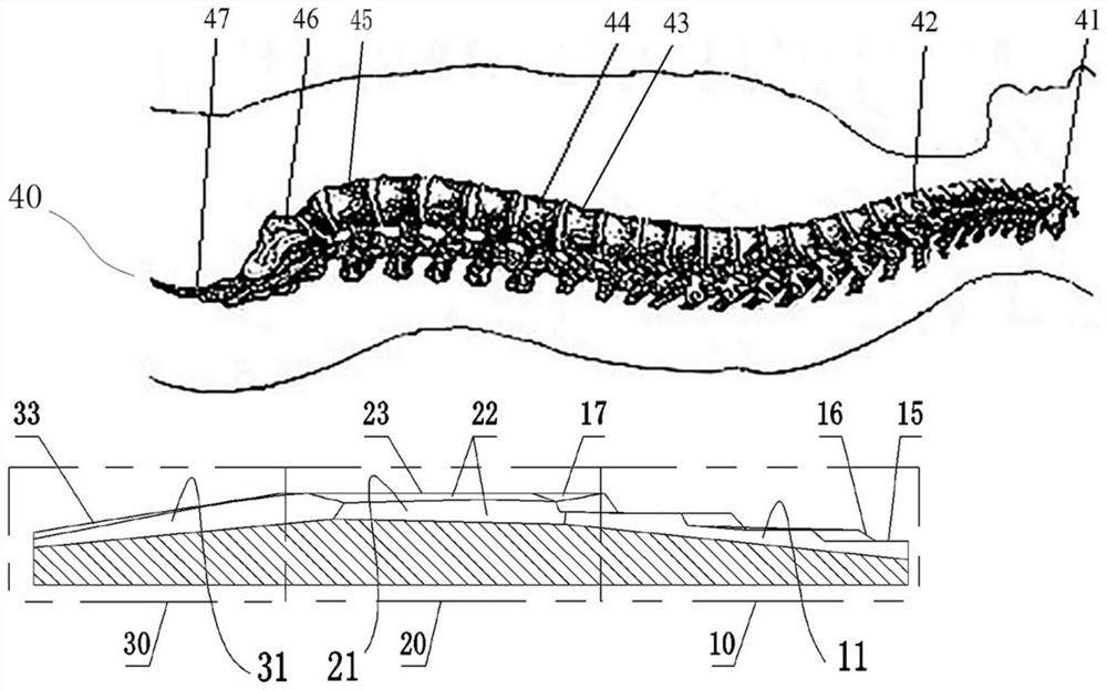 Spine tractor