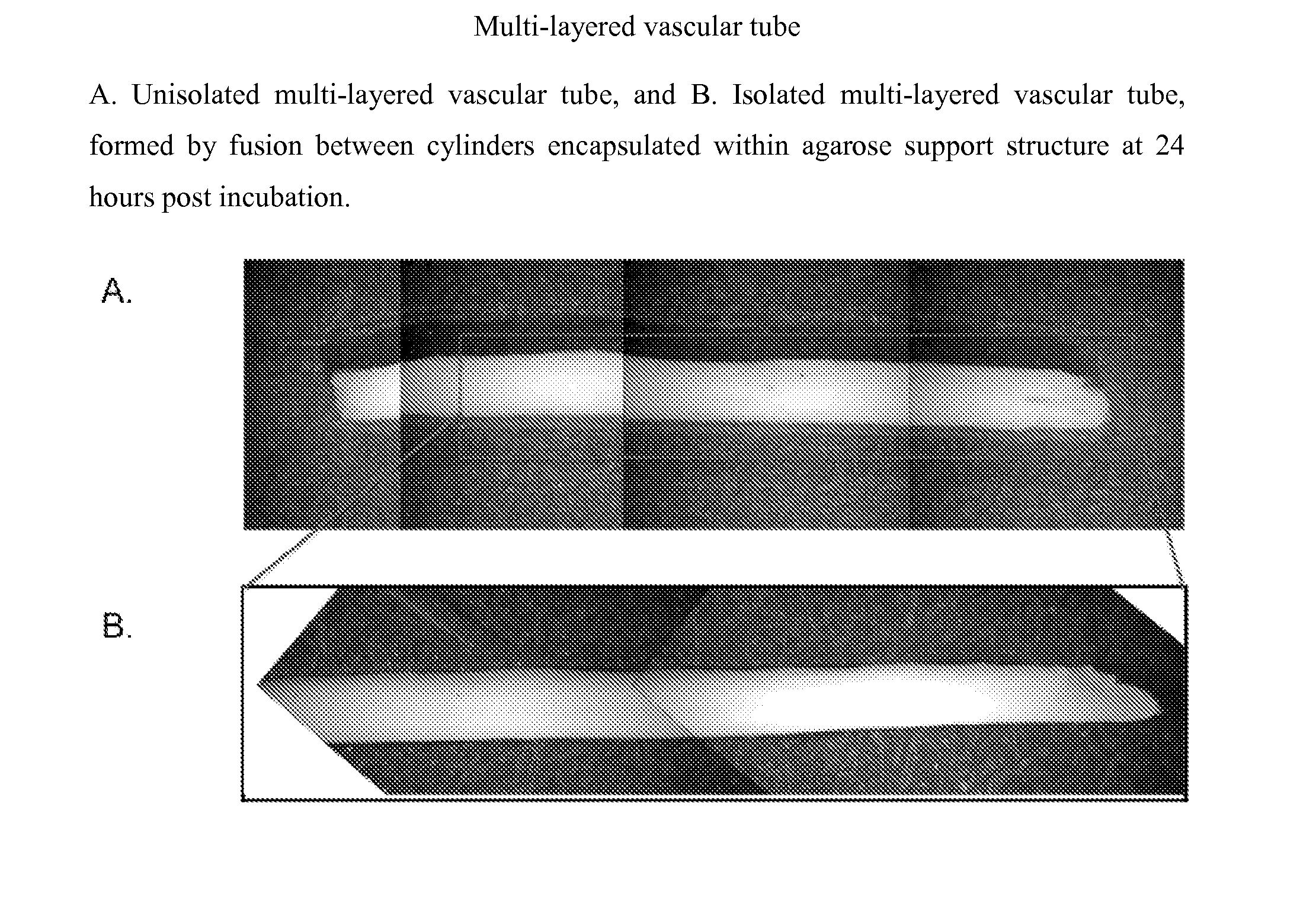 Multilayered vascular tubes