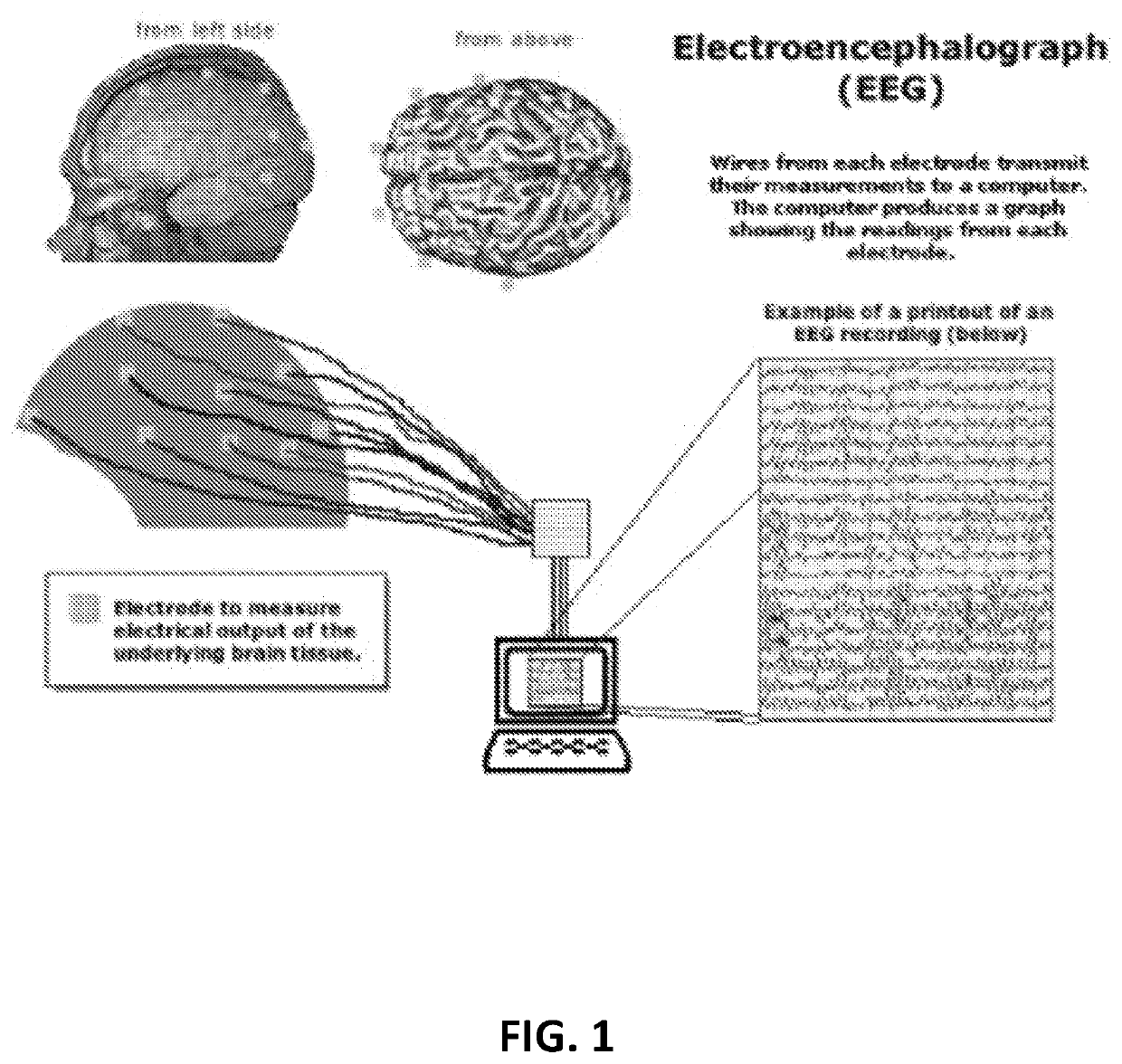 System and method to diagnose and predict different systemic disorders and mental states