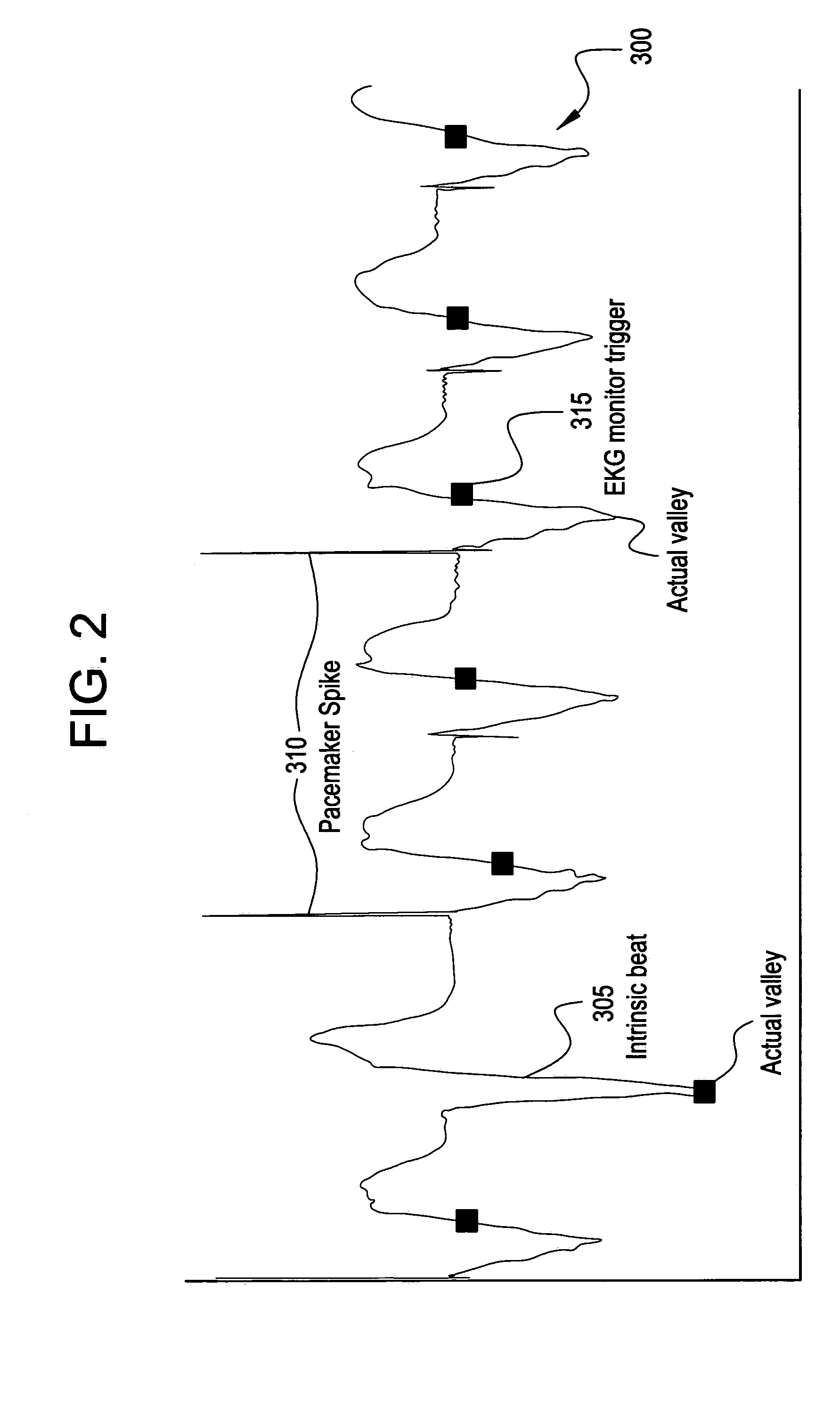 Method, apparatus and product for acquiring cardiac images