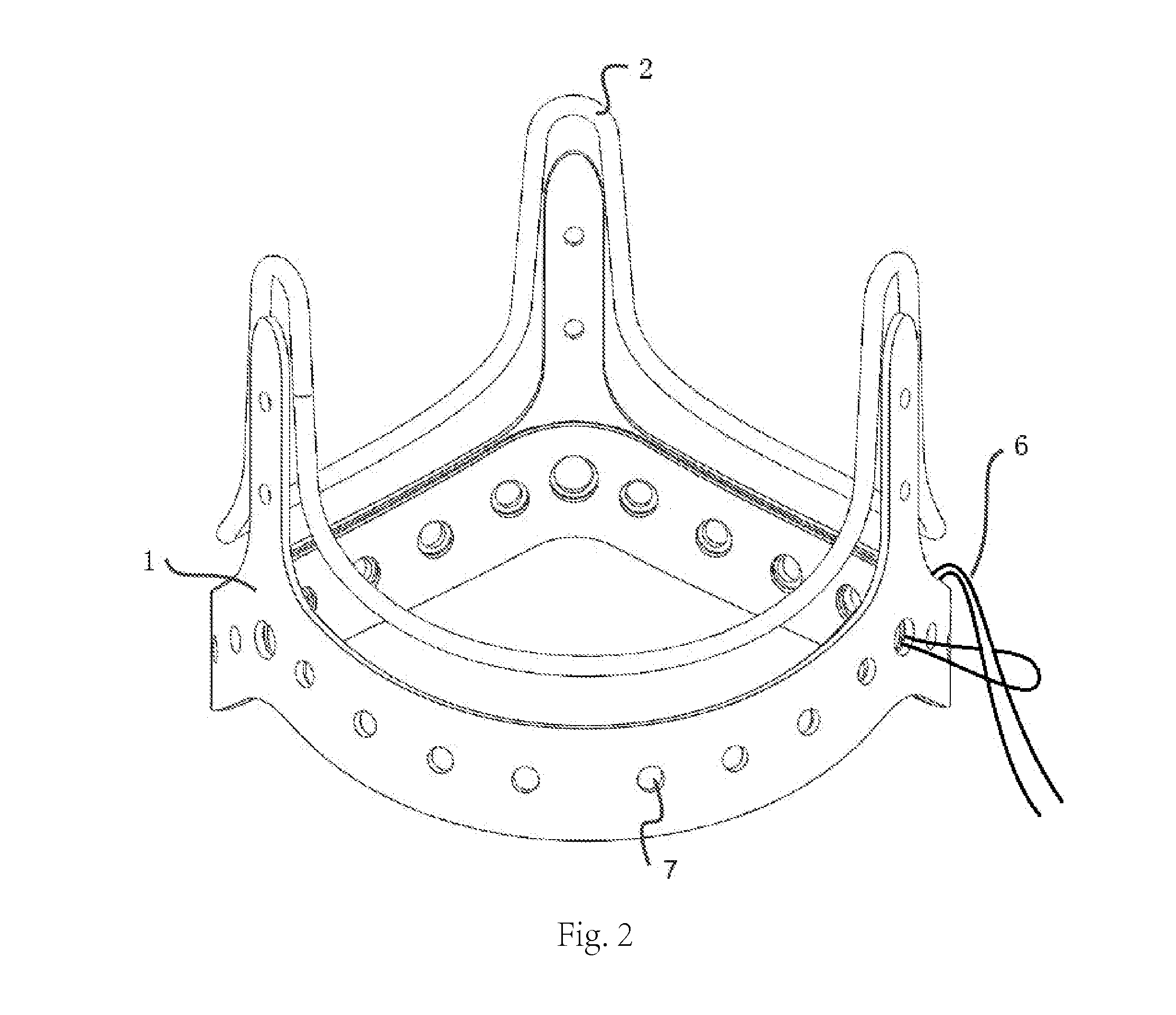 Prosthetic heart valve