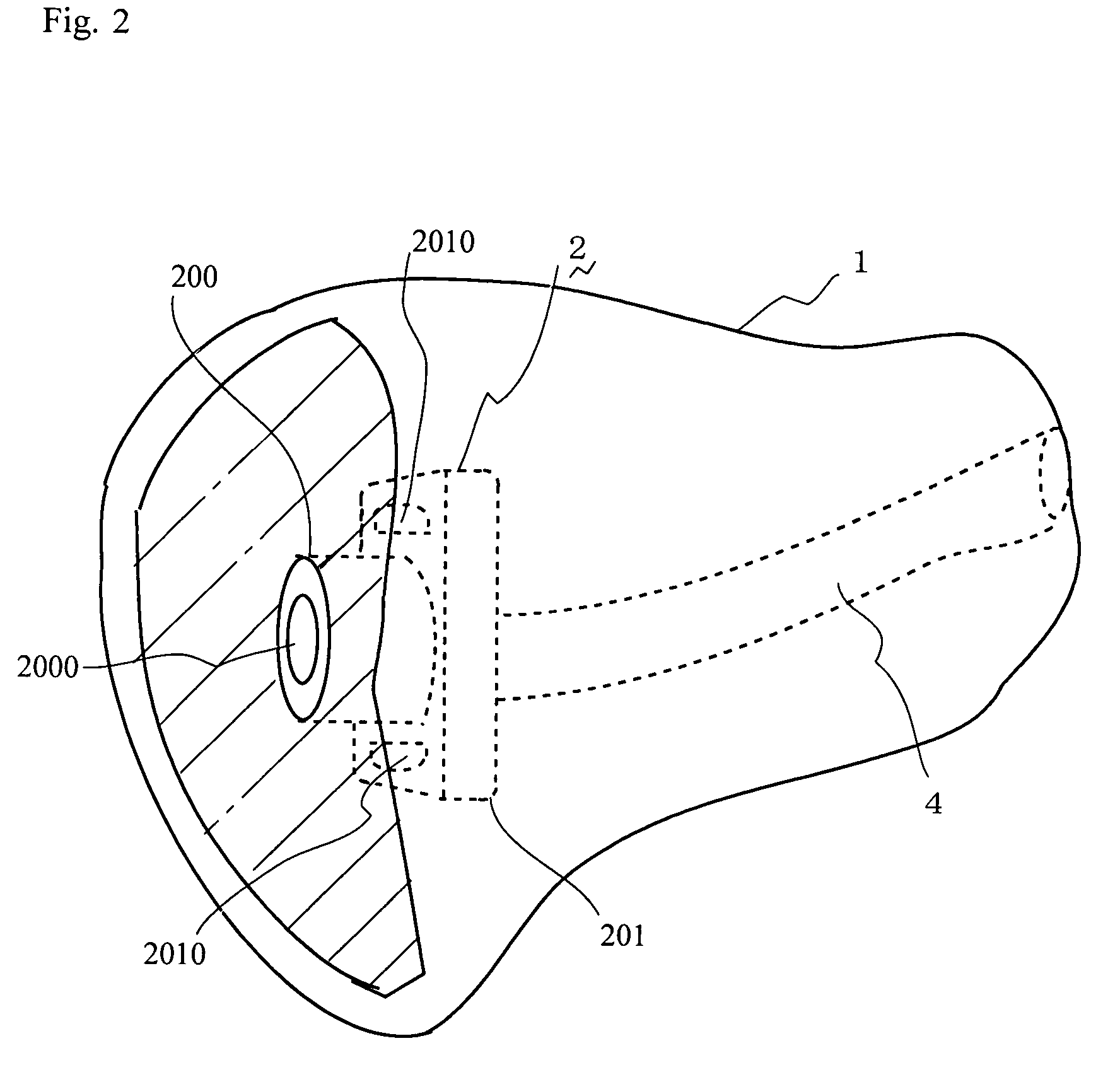 Ear Mold