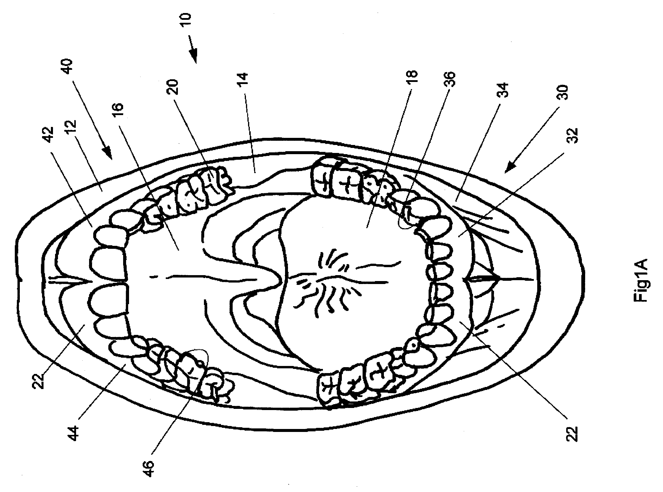 Methods, Devices, Systems and Kits for Isolating Teeth