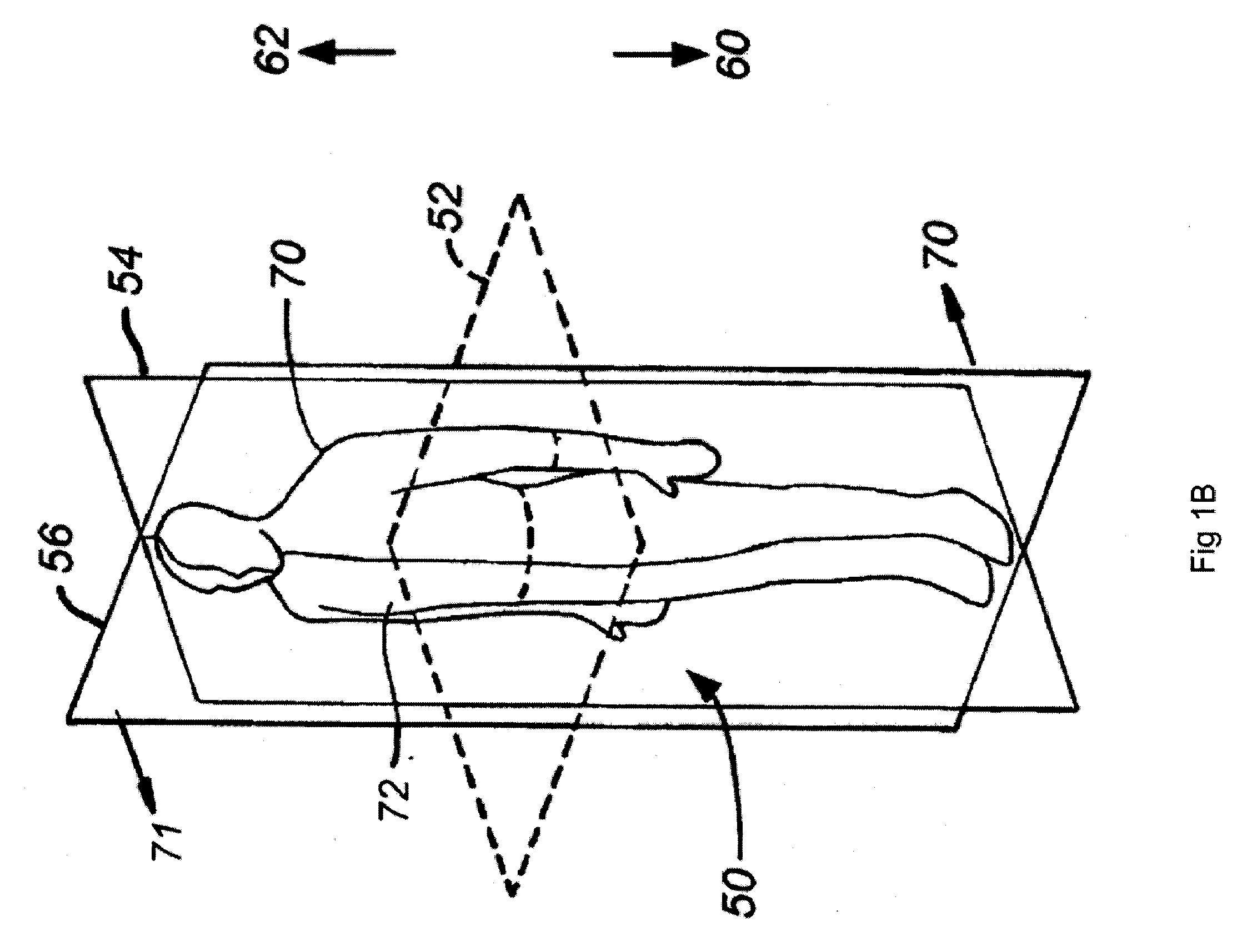 Methods, Devices, Systems and Kits for Isolating Teeth