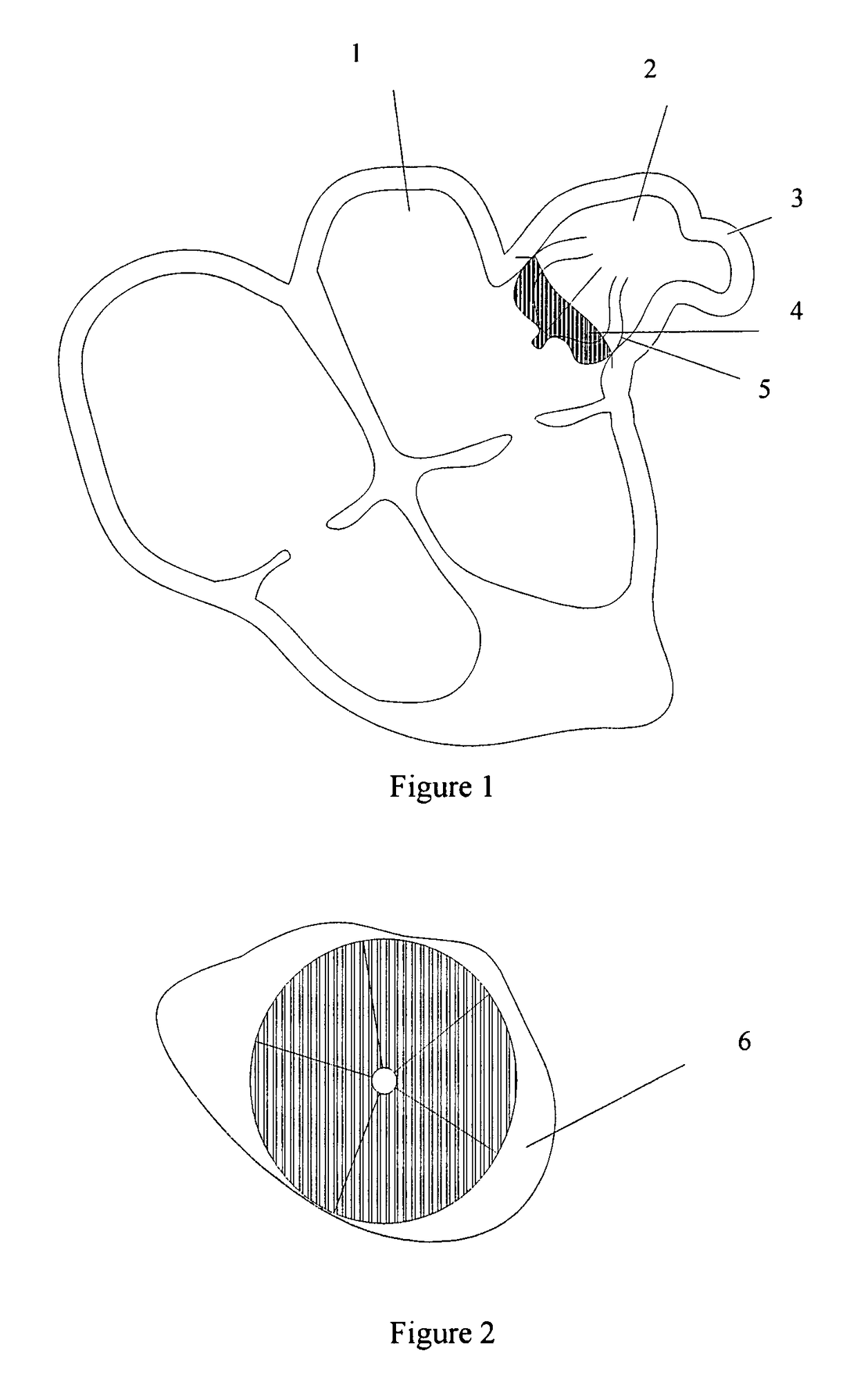 Left atrial appendage occluder