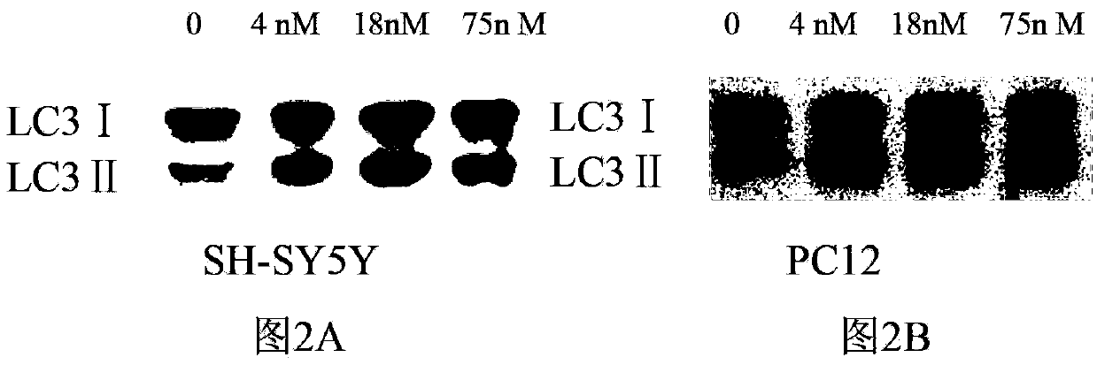 Method for eliminating alpha-synuclein generated in Parkinson's model cells by using cadmium telluride quantum dots and application thereof