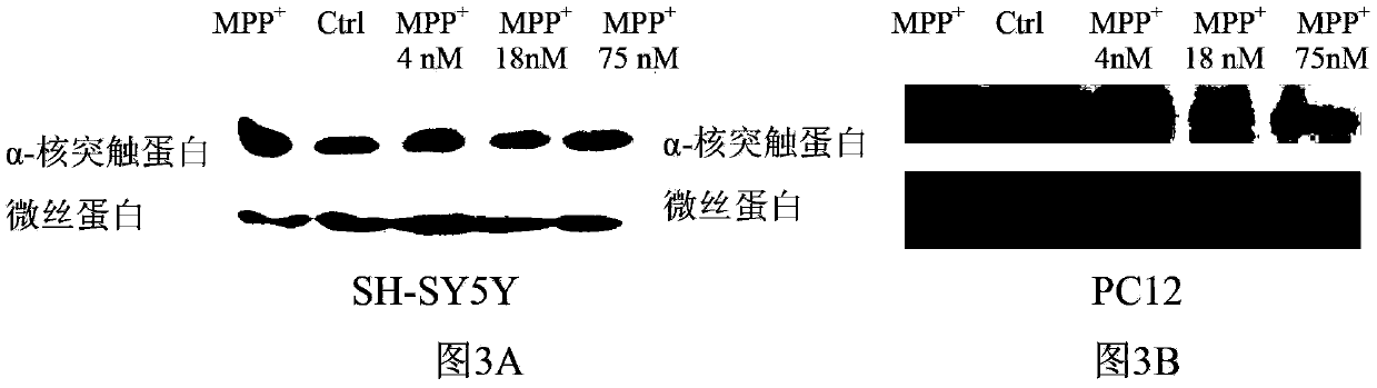 Method for eliminating alpha-synuclein generated in Parkinson's model cells by using cadmium telluride quantum dots and application thereof