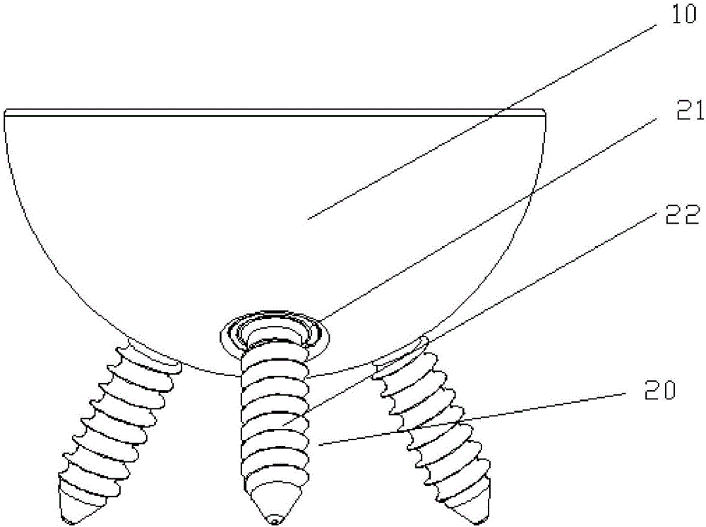 Acetabulum prosthesis