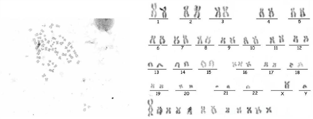 Chinese lung squamous carcinoma cell line and application thereof