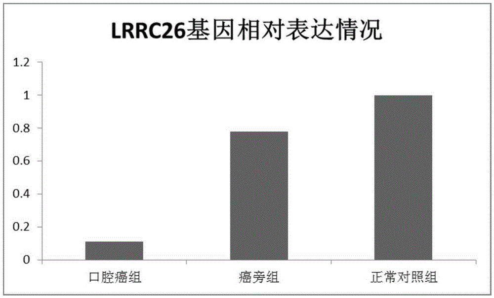 Application of differential expression of gene in oral cancer diagnosis