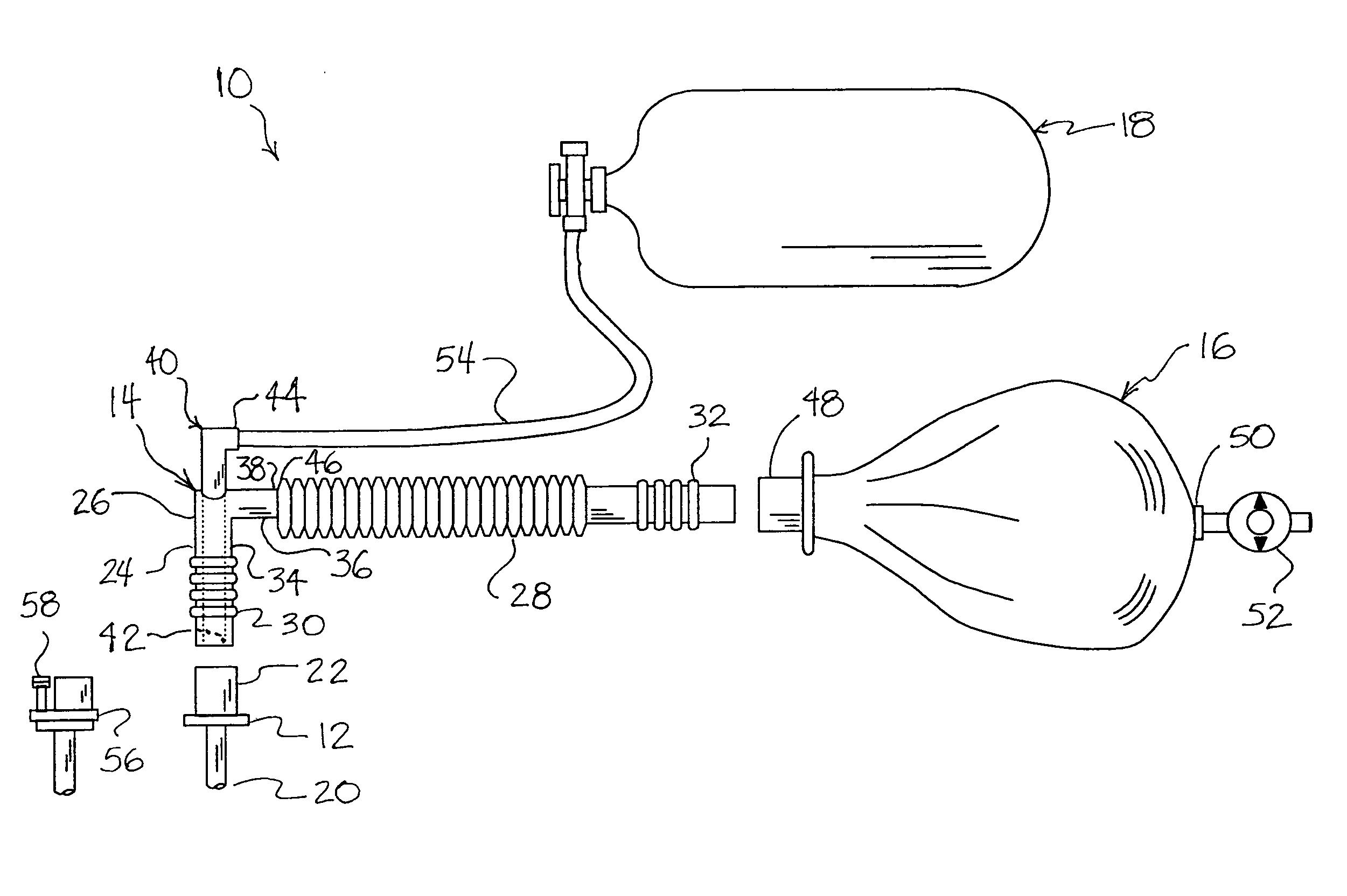 Breathing circuit